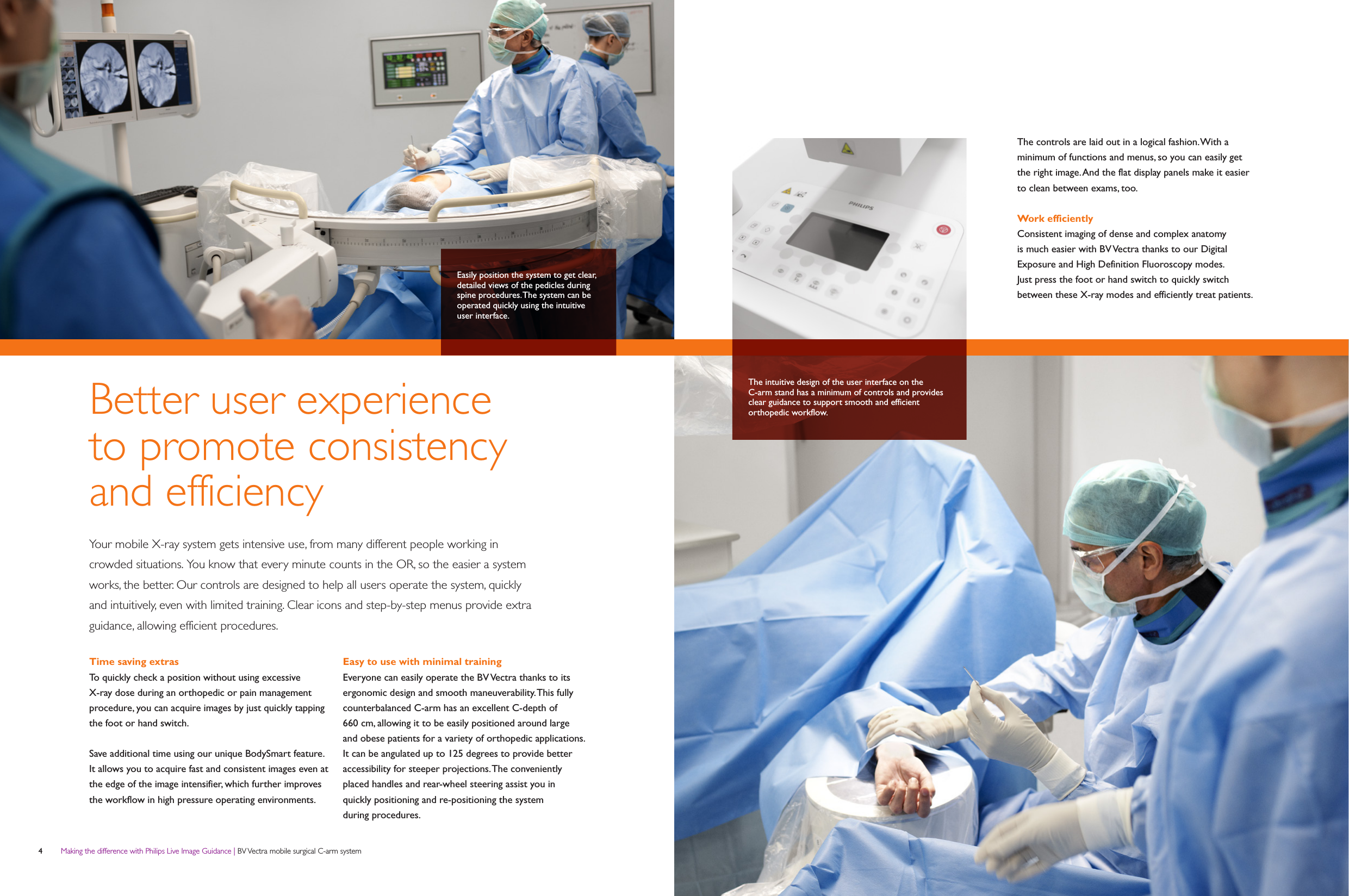 Philips NOCTN336 User Manual Product Brochure BV Vectra Mobile C arm