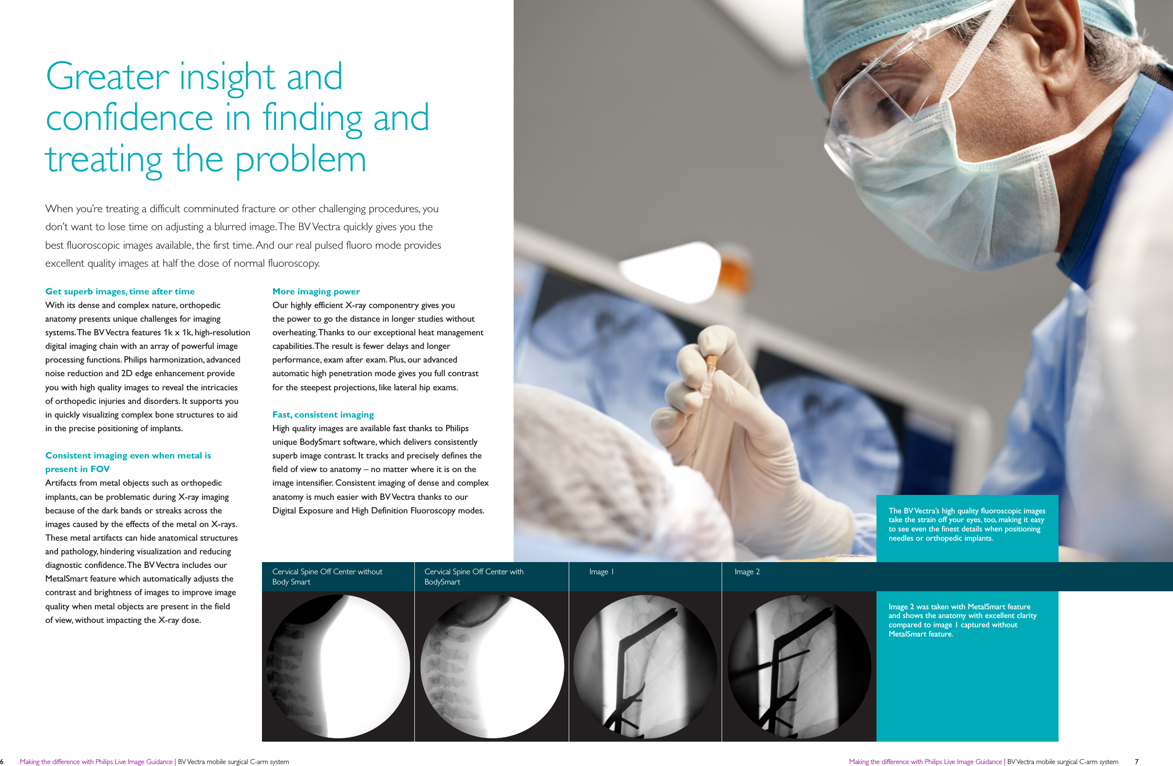 Philips NOCTN336 User Manual Product Brochure BV Vectra Mobile C arm