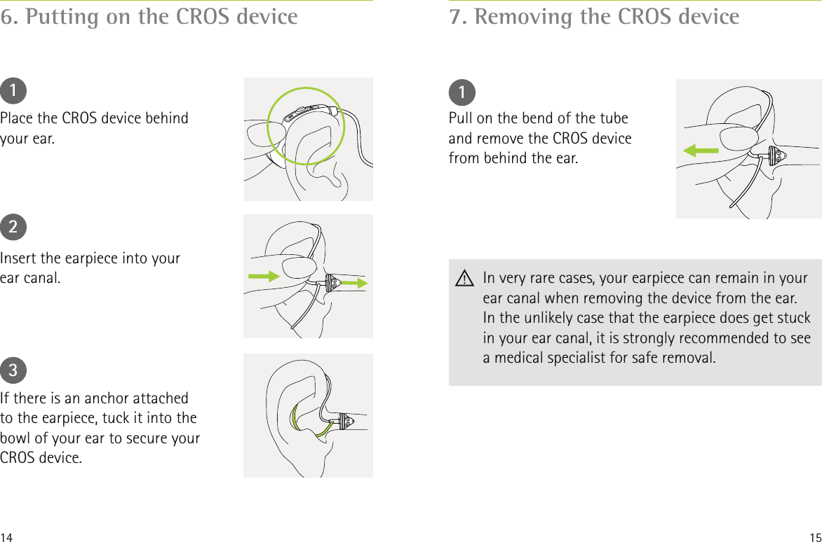 14 156. Putting on the CROS device123Place the CROS device behind  your ear.Insert the earpiece into your  ear canal.If there is an anchor attached  to the earpiece, tuck it into the bowl of your ear to secure your CROS device.7. Removing the CROS device1Pull on the bend of the tube and remove the CROS device from behind the ear.   In very rare cases, your earpiece can remain in your ear canal when removing the device from the ear. In the unlikely case that the earpiece does get stuck in your ear canal, it is strongly recommended to see a medical specialist for safe removal.