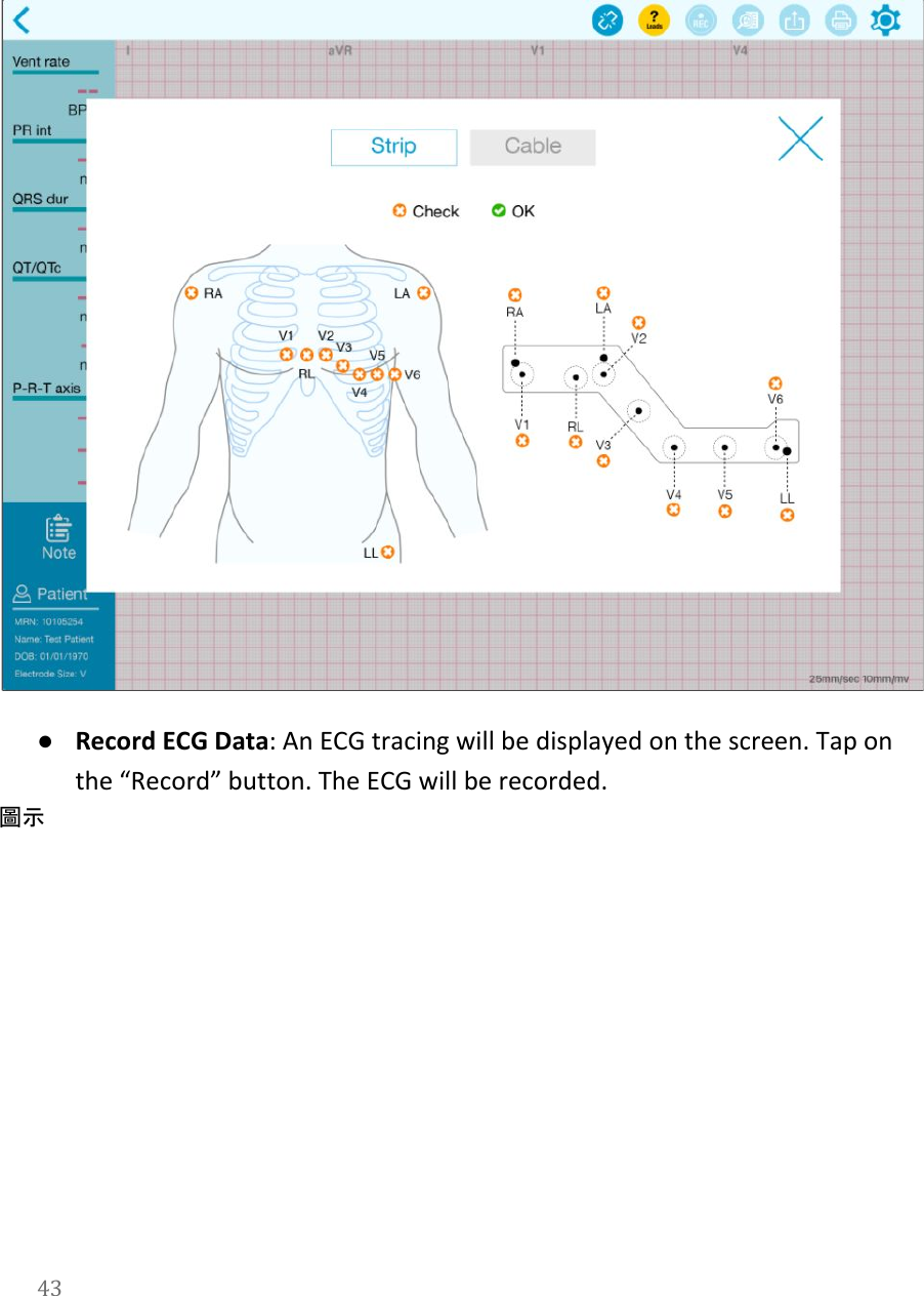    ●Record ECG Data: An ECG tracing will be displayed on the screen. Tap on the &ldquo;Record&rdquo; button. The ECG will be recorded.  圖示43  