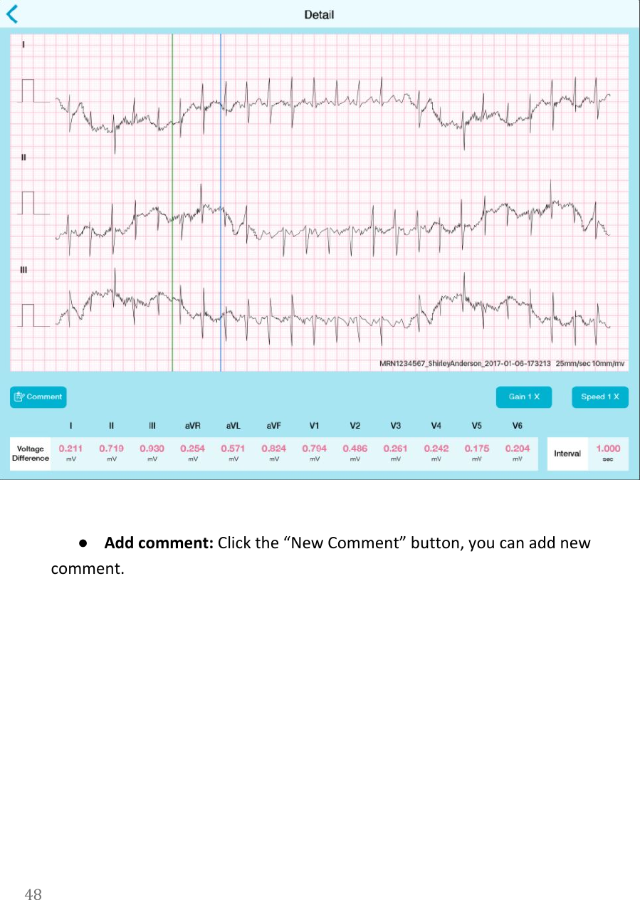     ●Add comment: Click the &ldquo;New Comment&rdquo; button, you can add new comment. 48  