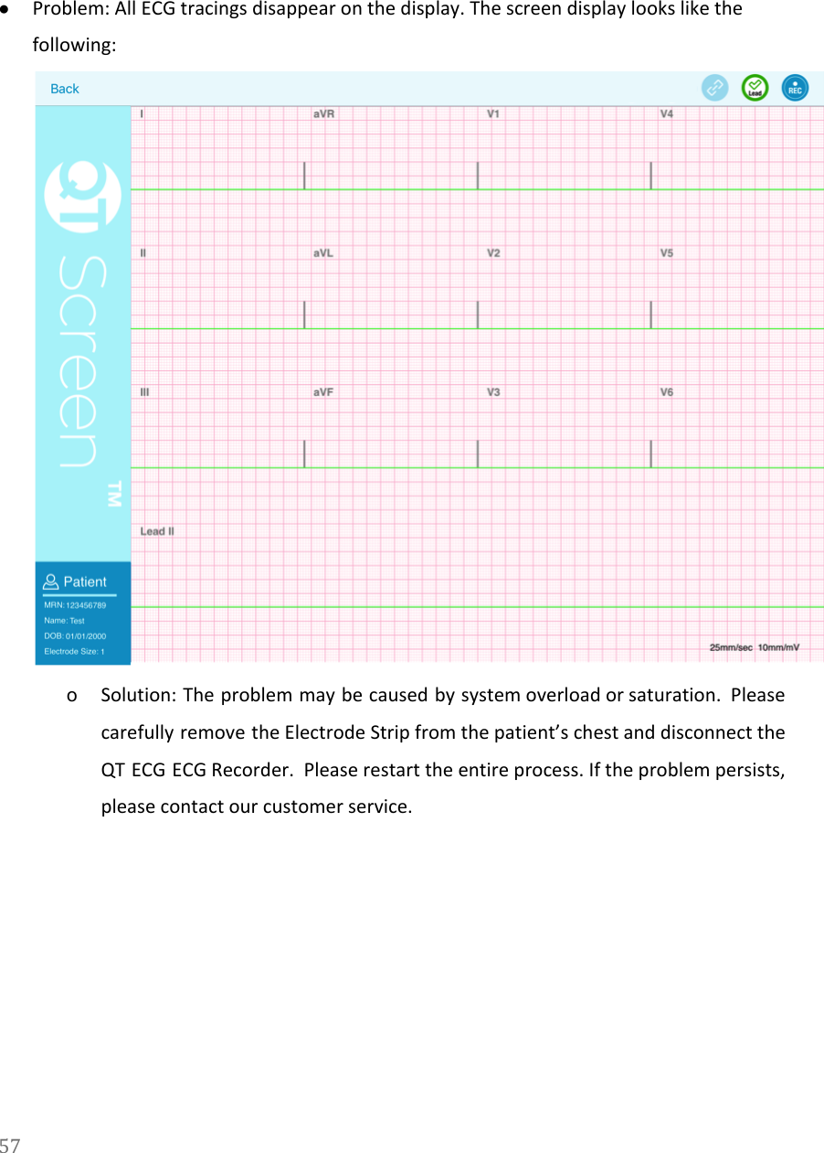   ●Problem: All ECG tracings disappear on the display. The screen display looks like the following:  oSolution: The problem may be caused by system overload or saturation. Please                       carefully remove the Electrode Strip from the patient&rsquo;s chest and disconnect the                       QT ECG ECG Recorder. Please restart the entire process. If the problem persists,                         please contact our customer service. 57  