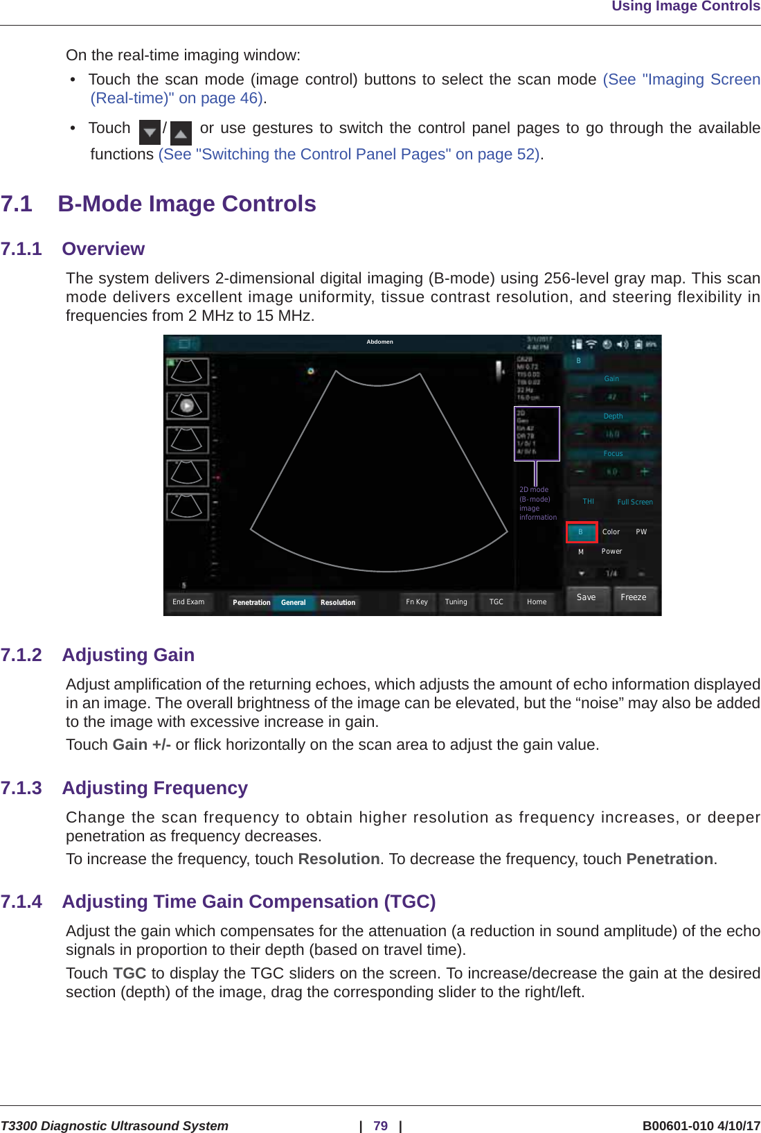 Using Image ControlsT3300 Diagnostic Ultrasound System |79 | B00601-010 4/10/17On the real-time imaging window:• Touch the scan mode (image control) buttons to select the scan mode (See &quot;Imaging Screen(Real-time)&quot; on page 46).• Touch  /  or use gestures to switch the control panel pages to go through the availablefunctions (See &quot;Switching the Control Panel Pages&quot; on page 52).7.1 B-Mode Image Controls7.1.1 OverviewThe system delivers 2-dimensional digital imaging (B-mode) using 256-level gray map. This scanmode delivers excellent image uniformity, tissue contrast resolution, and steering flexibility infrequencies from 2 MHz to 15 MHz. 7.1.2 Adjusting GainAdjust amplification of the returning echoes, which adjusts the amount of echo information displayedin an image. The overall brightness of the image can be elevated, but the “noise” may also be addedto the image with excessive increase in gain.Touch Gain +/- or flick horizontally on the scan area to adjust the gain value.7.1.3 Adjusting FrequencyChange the scan frequency to obtain higher resolution as frequency increases, or deeperpenetration as frequency decreases.To increase the frequency, touch Resolution. To decrease the frequency, touch Penetration.7.1.4 Adjusting Time Gain Compensation (TGC)Adjust the gain which compensates for the attenuation (a reduction in sound amplitude) of the echosignals in proportion to their depth (based on travel time).Touch TGC to display the TGC sliders on the screen. To increase/decrease the gain at the desiredsection (depth) of the image, drag the corresponding slider to the right/left.Save FreezeHomeTGCTuningResolutionGeneralPenetrationEnd ExamAbdomenGainDepthFocusTHI Full ScreenBColor PWMPowerB2D mode(B-mode)imageinformationFn Key