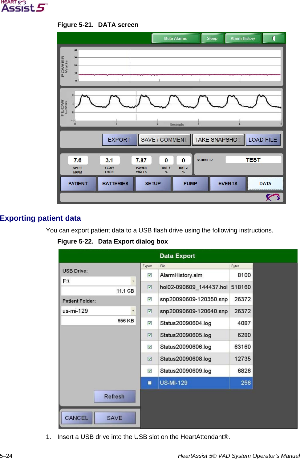   5–24  HeartAssist 5® VAD System Operator’s Manual  Figure 5-21.  DATA screen   Exporting patient data  You can export patient data to a USB flash drive using the following instructions.  Figure 5-22.  Data Export dialog box   1.  Insert a USB drive into the USB slot on the HeartAttendant®.  