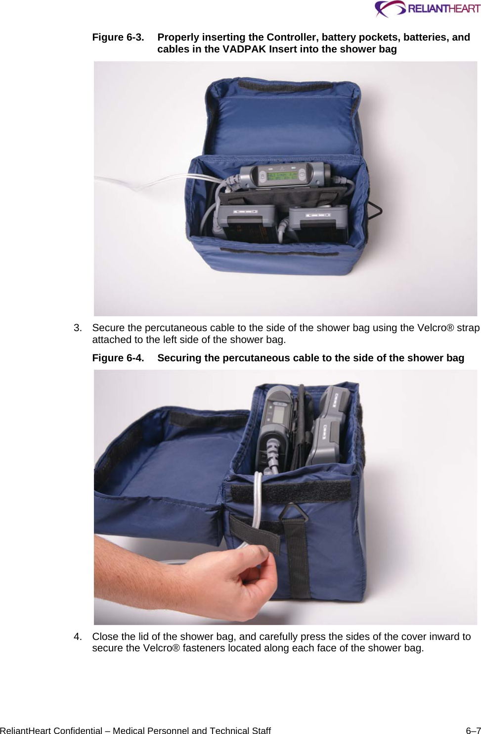     ReliantHeart Confidential – Medical Personnel and Technical Staff  6–7 Figure 6-3.  Properly inserting the Controller, battery pockets, batteries, and cables in the VADPAK Insert into the shower bag   3.  Secure the percutaneous cable to the side of the shower bag using the Velcro® strap attached to the left side of the shower bag.  Figure 6-4.  Securing the percutaneous cable to the side of the shower bag   4.  Close the lid of the shower bag, and carefully press the sides of the cover inward to secure the Velcro® fasteners located along each face of the shower bag.  