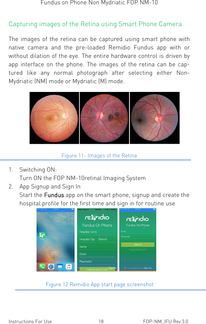 Fundus on Phone Non Mydriatic FOP NM-10    Instructions For Use  18  FOP-NM_IFU Rev 3.0 Capturing images of the Retina using Smart Phone Camera  The  images of  the  retina can be  captured  using smart phone with native  camera  and  the  pre-loaded  Remidio  Fundus  app  with  or without dilation of the eye. The entire hardware control is driven by app  interface  on  the  phone.  The  images  of  the  retina  can  be  cap-tured  like  any  normal  photograph  after  selecting  either  Non-Mydriatic (NM) mode or Mydriatic (M) mode.  Figure 11- Images of the Retina 1. Switching ON: Turn ON the FOP NM-10retinal Imaging System 2. App Signup and Sign In Start the Fundus app on the smart phone, signup and create the hospital profile for the first time and sign in for routine use                                         Figure 12 Remidio App start page screenshot 