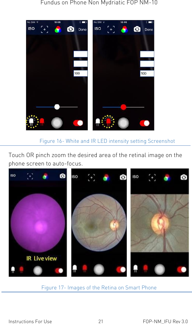 Fundus on Phone Non Mydriatic FOP NM-10    Instructions For Use  21  FOP-NM_IFU Rev 3.0                         Figure 16- White and IR LED intensity setting Screenshot Touch OR pinch zoom the desired area of the retinal image on the phone screen to auto-focus.                Figure 17- Images of the Retina on Smart Phone 