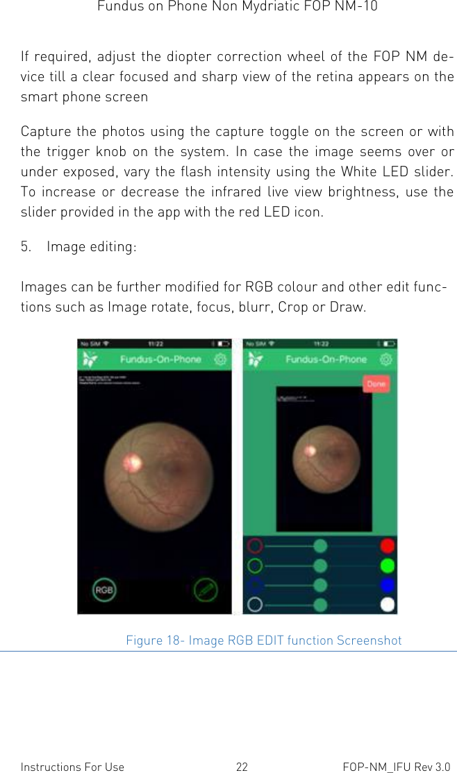 Fundus on Phone Non Mydriatic FOP NM-10    Instructions For Use  22  FOP-NM_IFU Rev 3.0 If required, adjust the diopter correction wheel of the FOP NM de-vice till a clear focused and sharp view of the retina appears on the smart phone screen Capture the photos using the capture  toggle on the screen or with the  trigger  knob  on  the  system.  In  case  the  image  seems  over  or under exposed, vary the flash intensity using the White LED slider. To  increase  or  decrease  the  infrared  live  view  brightness,  use the slider provided in the app with the red LED icon.  5. Image editing: Images can be further modified for RGB colour and other edit func-tions such as Image rotate, focus, blurr, Crop or Draw.                                                        Figure 18- Image RGB EDIT function Screenshot 