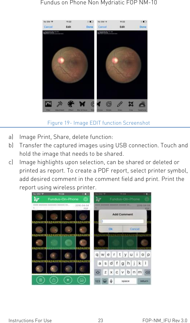Fundus on Phone Non Mydriatic FOP NM-10    Instructions For Use  23  FOP-NM_IFU Rev 3.0                       Figure 19- Image EDIT function Screenshot a) Image Print, Share, delete function: b) Transfer the captured images using USB connection. Touch and hold the image that needs to be shared.  c) Image highlights upon selection, can be shared or deleted or printed as report. To create a PDF report, select printer symbol, add desired comment in the comment field and print. Print the report using wireless printer.                  