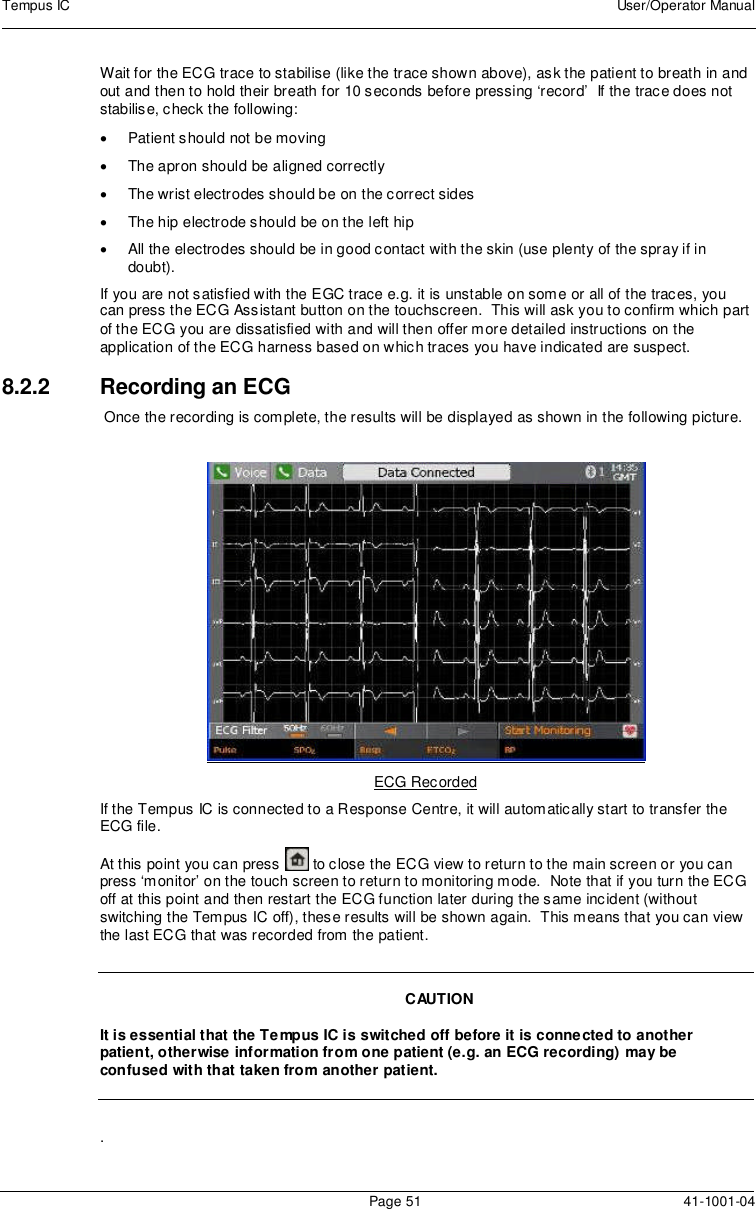 Tempus IC User/Operator ManualPage 51 41-1001-04Wait for the ECG trace to stabilise (like the trace shown above), ask the patient to breath in andout and then to hold their breath for 10 seconds before pressing ‘record’ If the trace does notstabilise, check the following:Patient should not be movingThe apron should be aligned correctlyThe wrist electrodes should be on the correct sidesThe hip electrode should be on the left hipAll the electrodes should be in good contact with the skin (use plenty of the spray if indoubt).If you are not satisfied with the EGC trace e.g. it is unstable on some or all of the traces, youcan press the ECG Assistant button on the touchscreen. This will ask you to confirm which partof the ECG you are dissatisfied with and will then offer more detailed instructions on theapplication of the ECG harness based on which traces you have indicated are suspect.8.2.2 Recording an ECGOnce the recording is complete, the results will be displayed as shown in the following picture.ECG RecordedIf the Tempus IC is connected to a Response Centre, it will automatically start to transfer theECG file.At this point you can press to close the ECG view to return to the main screen or you canpress ‘monitor’ on the touch screen to return to monitoring mode. Note that if you turn the ECGoff at this point and then restart the ECG function later during the same incident (withoutswitching the Tempus IC off), these results will be shown again. This means that you can viewthe last ECG that was recorded from the patient.CAUTIONIt is essential that the Tempus IC is switched off before it is connected to anotherpatient, otherwise information from one patient (e.g. an ECG recording) may beconfused with that taken from another patient..