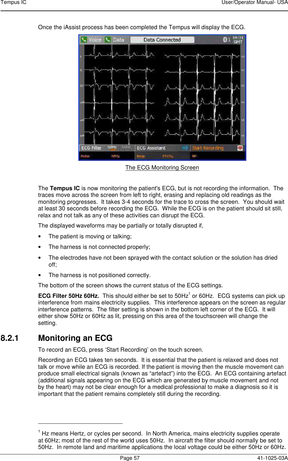 Tempus IC    User/Operator Manual- USA        Page 57  41-1025-03A Once the iAssist process has been completed the Tempus will display the ECG.  The ECG Monitoring Screen  The Tempus IC is now monitoring the patient&apos;s ECG, but is not recording the information.  The traces move across the screen from left to right, erasing and replacing old readings as the monitoring progresses.  It takes 3-4 seconds for the trace to cross the screen.  You should wait at least 30 seconds before recording the ECG.  While the ECG is on the patient should sit still, relax and not talk as any of these activities can disrupt the ECG. The displayed waveforms may be partially or totally disrupted if, •  The patient is moving or talking; •  The harness is not connected properly; •  The electrodes have not been sprayed with the contact solution or the solution has dried off; •  The harness is not positioned correctly. The bottom of the screen shows the current status of the ECG settings.   ECG Filter 50Hz 60Hz.  This should either be set to 50Hz1 or 60Hz.  ECG systems can pick up interference from mains electricity supplies.  This interference appears on the screen as regular interference patterns.  The filter setting is shown in the bottom left corner of the ECG.  It will either show 50Hz or 60Hz as lit, pressing on this area of the touchscreen will change the setting. 8.2.1  Monitoring an ECG To record an ECG, press ‘Start Recording’ on the touch screen.   Recording an ECG takes ten seconds.  It is essential that the patient is relaxed and does not talk or move while an ECG is recorded. If the patient is moving then the muscle movement can produce small electrical signals (known as “artefact”) into the ECG.  An ECG containing artefact (additional signals appearing on the ECG which are generated by muscle movement and not by the heart) may not be clear enough for a medical professional to make a diagnosis so it is important that the patient remains completely still during the recording.                                             1 Hz means Hertz, or cycles per second.  In North America, mains electricity supplies operate at 60Hz; most of the rest of the world uses 50Hz.  In aircraft the filter should normally be set to 50Hz.  In remote land and maritime applications the local voltage could be either 50Hz or 60Hz.   