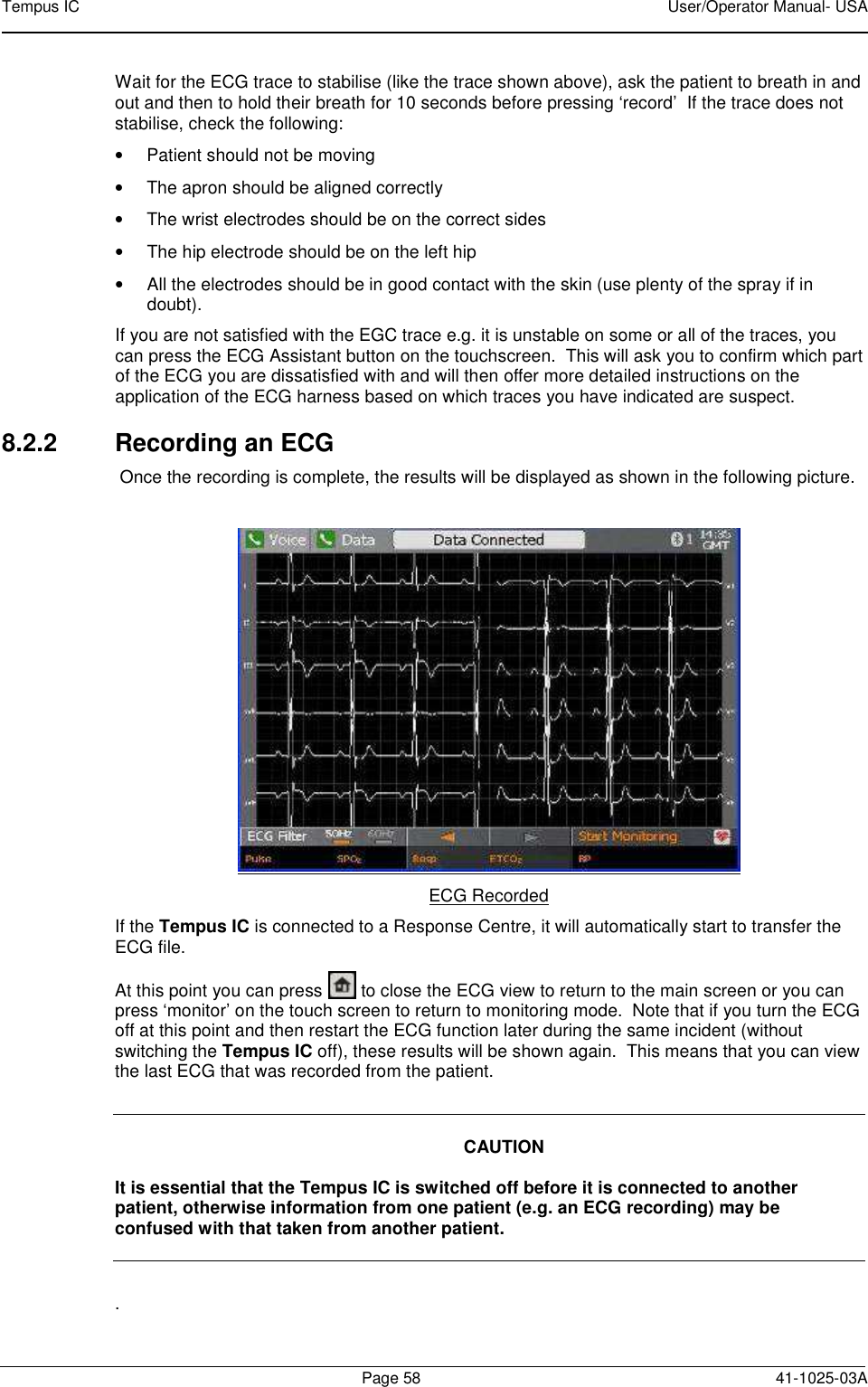 Tempus IC    User/Operator Manual- USA        Page 58  41-1025-03A Wait for the ECG trace to stabilise (like the trace shown above), ask the patient to breath in and out and then to hold their breath for 10 seconds before pressing ‘record’  If the trace does not stabilise, check the following: •  Patient should not be moving •  The apron should be aligned correctly •  The wrist electrodes should be on the correct sides •  The hip electrode should be on the left hip •  All the electrodes should be in good contact with the skin (use plenty of the spray if in doubt). If you are not satisfied with the EGC trace e.g. it is unstable on some or all of the traces, you can press the ECG Assistant button on the touchscreen.  This will ask you to confirm which part of the ECG you are dissatisfied with and will then offer more detailed instructions on the application of the ECG harness based on which traces you have indicated are suspect. 8.2.2  Recording an ECG  Once the recording is complete, the results will be displayed as shown in the following picture.     ECG Recorded If the Tempus IC is connected to a Response Centre, it will automatically start to transfer the ECG file.   At this point you can press   to close the ECG view to return to the main screen or you can press ‘monitor’ on the touch screen to return to monitoring mode.  Note that if you turn the ECG off at this point and then restart the ECG function later during the same incident (without switching the Tempus IC off), these results will be shown again.  This means that you can view the last ECG that was recorded from the patient.      CAUTION  It is essential that the Tempus IC is switched off before it is connected to another patient, otherwise information from one patient (e.g. an ECG recording) may be confused with that taken from another patient.    .  
