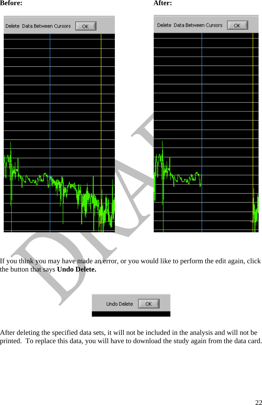   22Before:        After:            If you think you may have made an error, or you would like to perform the edit again, click the button that says Undo Delete.      After deleting the specified data sets, it will not be included in the analysis and will not be printed.  To replace this data, you will have to download the study again from the data card.       