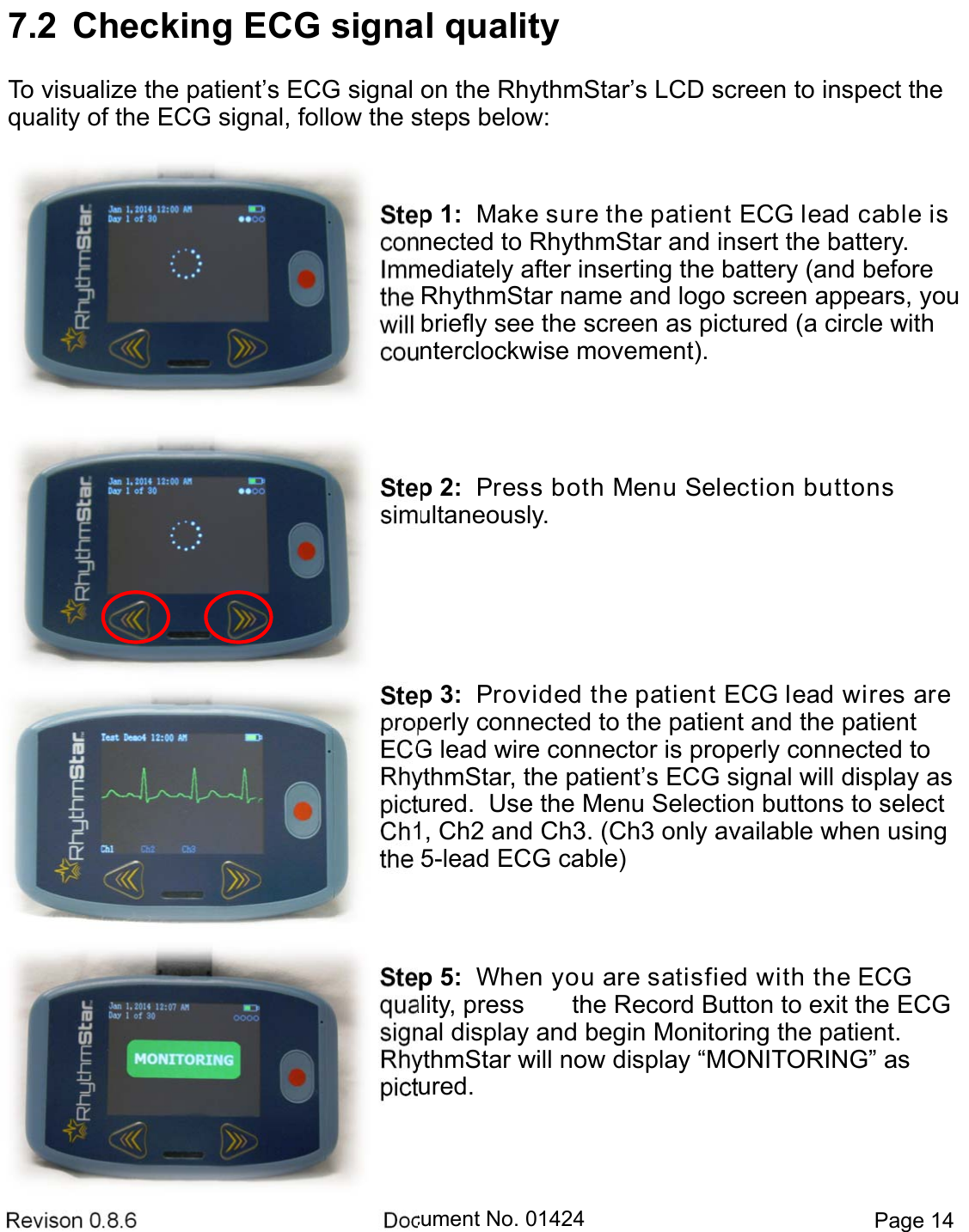 Revison 0.8.6  Document No. 01424  Page 14 Step 1:  Make sure the patient ECG lead cable is  connected to RhythmStar and insert the battery.   Immediately after inserting the battery (and before the RhythmStar name and logo screen appears, you will briefly see the screen as pictured (a circle with counterclockwise movement). Step 2:  Press both Menu Selection buttons simultaneously.  Step 3:  Provided the patient ECG lead wires are  properly connected to the patient and the patient ECG lead wire connector is properly connected to RhythmStar, the patient’s ECG signal will display as  pictured.  Use the Menu Selection buttons to select Ch1, Ch2 and Ch3. (Ch3 only available when using the 5-lead ECG cable) Step 5:  When you are satisfied with the ECG quality, press  the Record Button to exit the ECG signal display and begin Monitoring the patient.  RhythmStar will now display “MONITORING” as  pictured.  7.2  Checking ECG signal qualityTo visualize the patient’s ECG signal on the RhythmStar’s LCD screen to inspect the quality of the ECG signal, follow the steps below: 