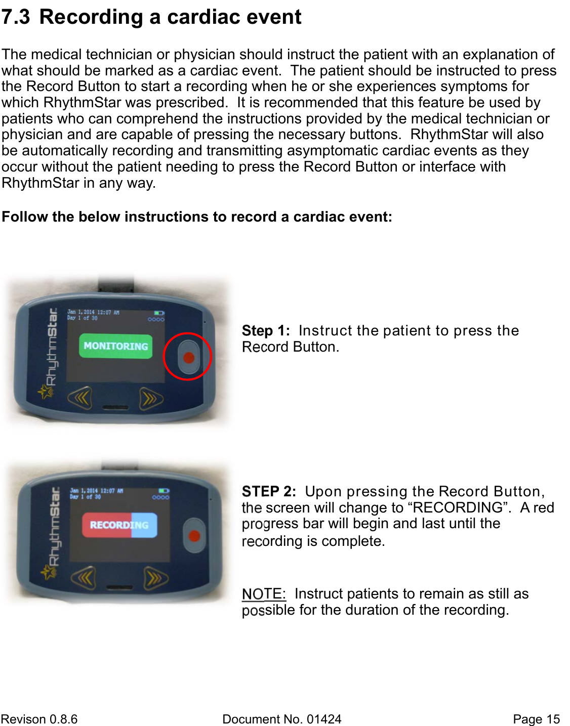 Revison 0.8.6  Document No. 01424   Page 15 7.3  Recording a cardiac eventThe medical technician or physician should instruct the patient with an explanation of what should be marked as a cardiac event.  The patient should be instructed to press the Record Button to start a recording when he or she experiences symptoms for which RhythmStar was prescribed.  It is recommended that this feature be used by patients who can comprehend the instructions provided by the medical technician or physician and are capable of pressing the necessary buttons.  RhythmStar will also be automatically recording and transmitting asymptomatic cardiac events as they    occur without the patient needing to press the Record Button or interface with RhythmStar in any way.  Follow the below instructions to record a cardiac event:  Step 1:  Instruct the patient to press the   Record Button.STEP 2:  Upon pressing the Record Button, the screen will change to “RECORDING”.  A red progress bar will begin and last until the           recording is complete.NOTE:  Instruct patients to remain as still as   possible for the duration of the recording. 