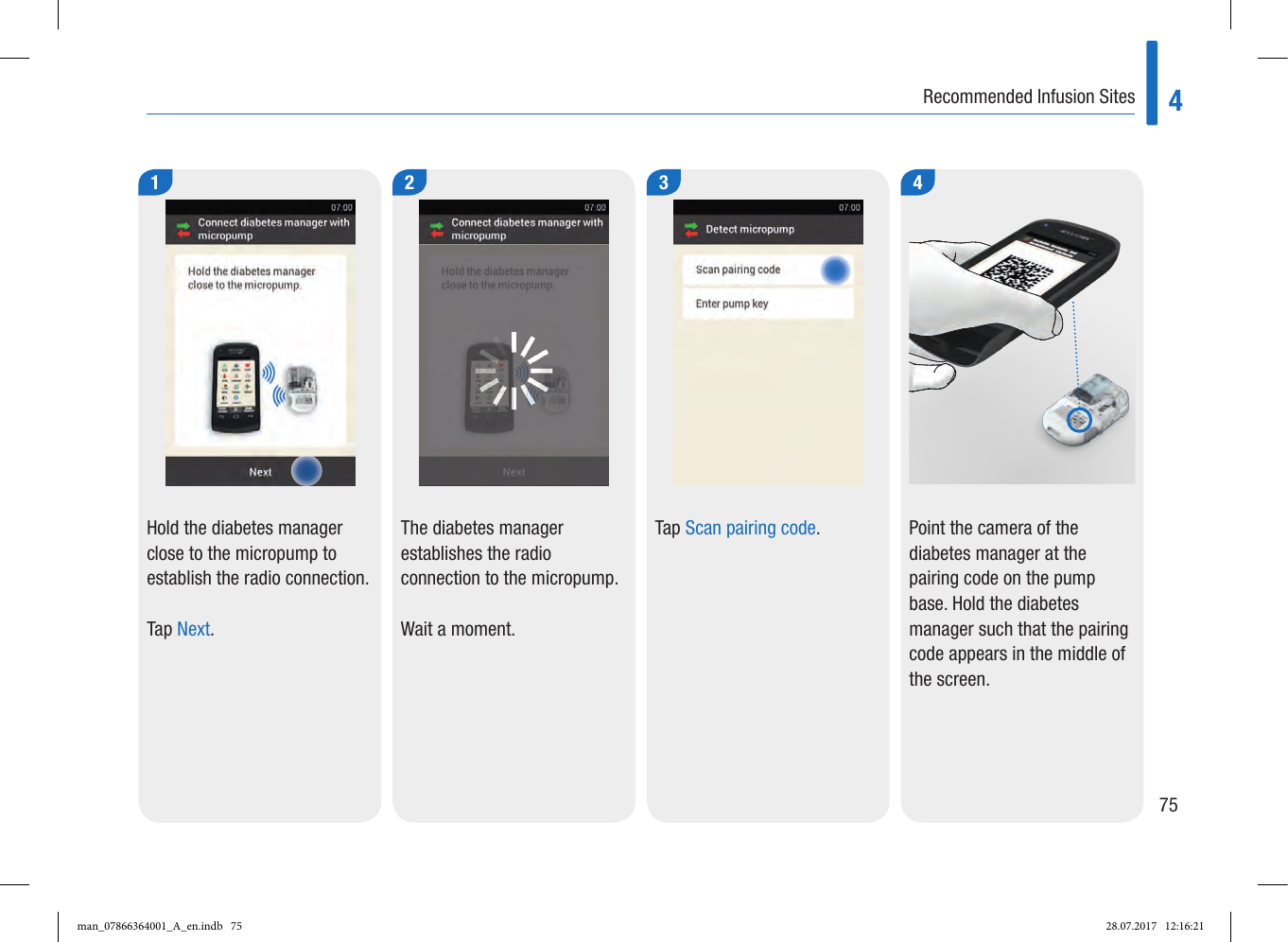 Page 17 of Roche Diagnostics Diabetes Care GW Accu-Chek  Solo micropump User Manual Part 2