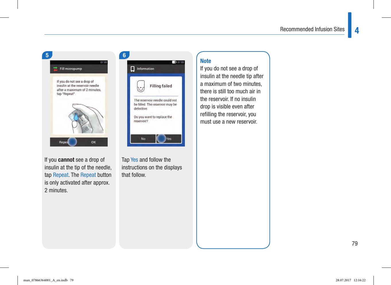 Page 21 of Roche Diagnostics Diabetes Care GW Accu-Chek  Solo micropump User Manual Part 2