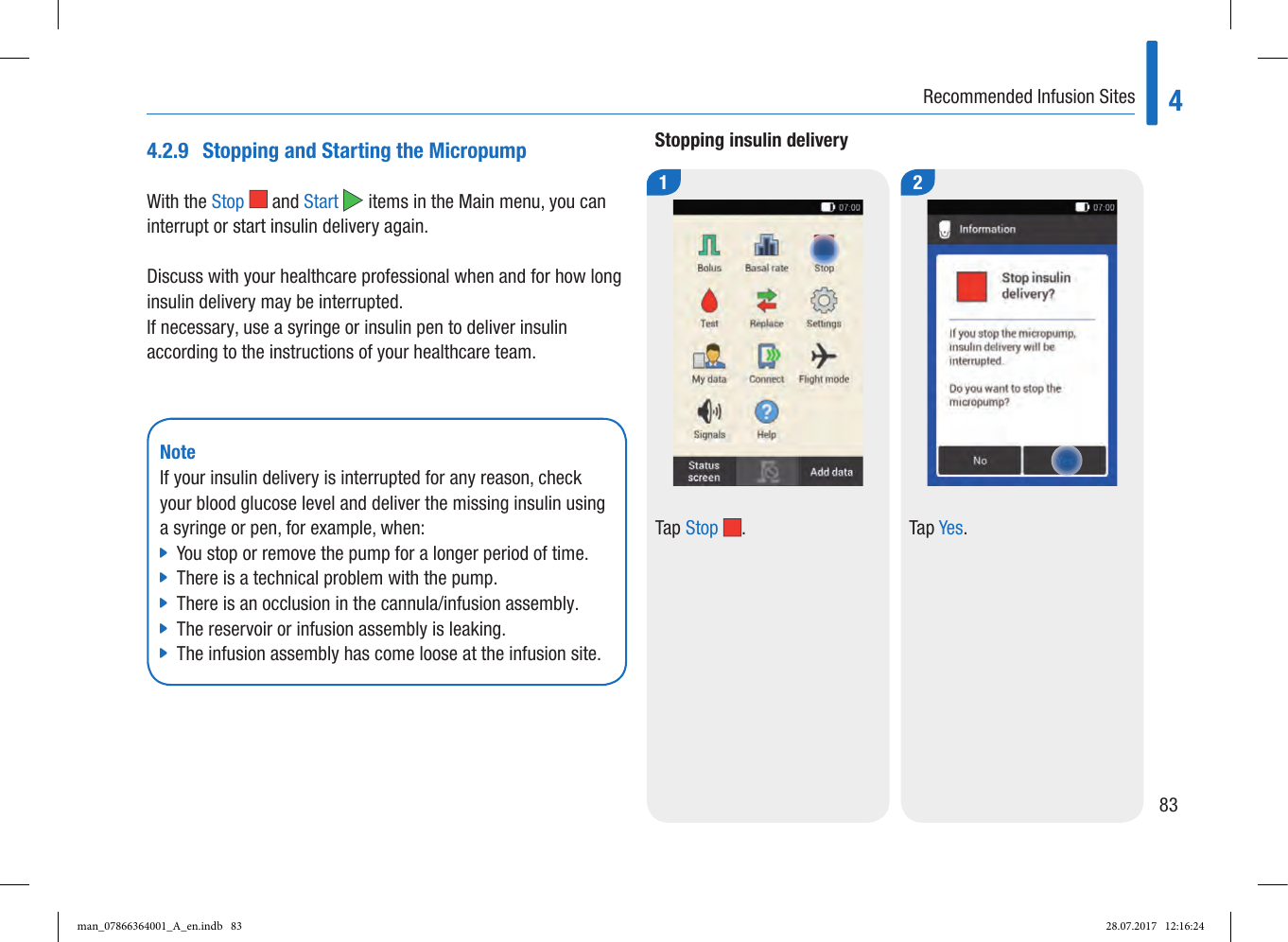 Page 25 of Roche Diagnostics Diabetes Care GW Accu-Chek  Solo micropump User Manual Part 2