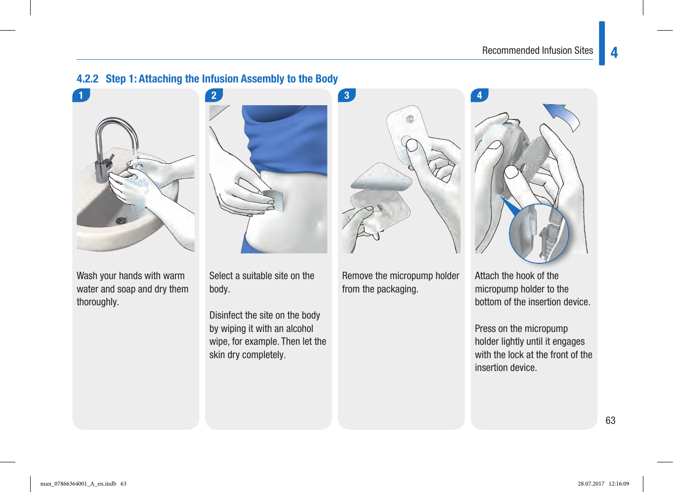 Page 5 of Roche Diagnostics Diabetes Care GW Accu-Chek  Solo micropump User Manual Part 2