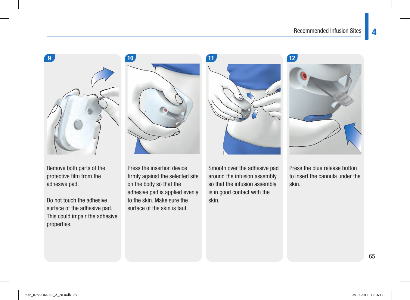 Page 7 of Roche Diagnostics Diabetes Care GW Accu-Chek  Solo micropump User Manual Part 2