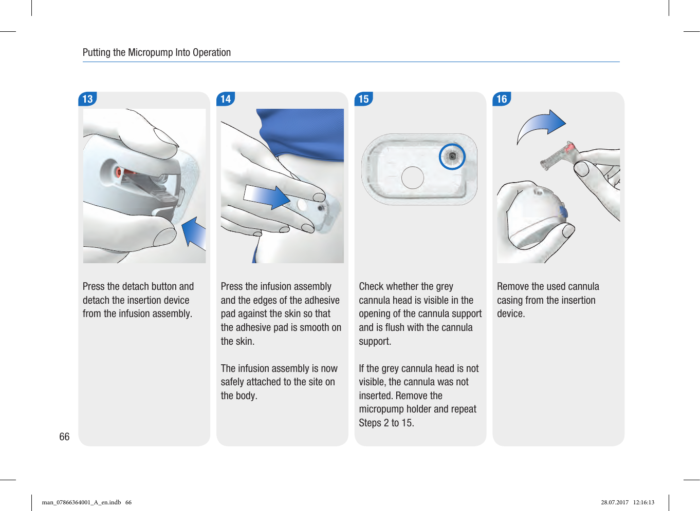 Page 8 of Roche Diagnostics Diabetes Care GW Accu-Chek  Solo micropump User Manual Part 2
