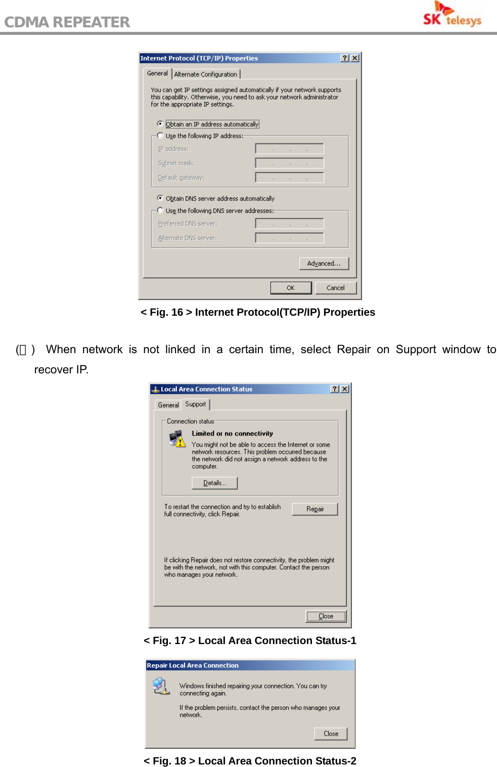 CDMA REPEATER                                            &lt; Fig. 16 &gt; Internet Protocol(TCP/IP) Properties  (４)  When network is not linked in a certain time, select Repair on Support window to recover IP.  &lt; Fig. 17 &gt; Local Area Connection Status-1  &lt; Fig. 18 &gt; Local Area Connection Status-2 