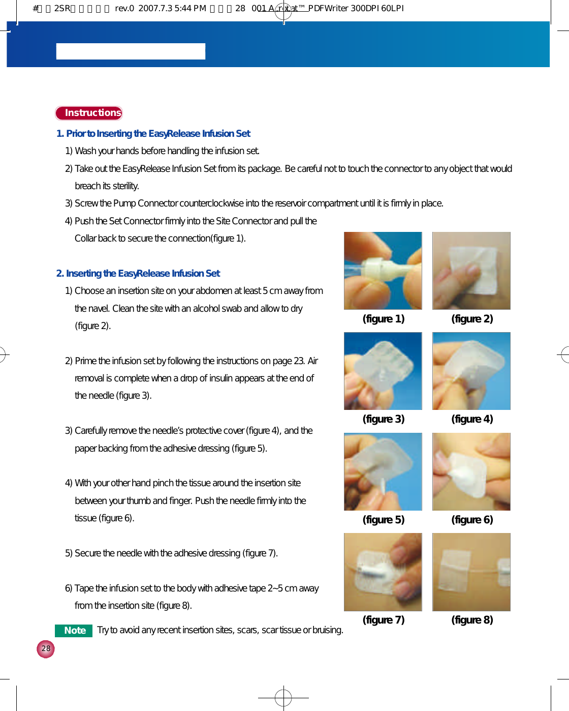 1. Prior to Inserting the EasyRelease Infusion Set1) Wash your hands before handling the infusion set. 2) Take out the EasyRelease Infusion Set from its package. Be careful not to touch the connector to any object that wouldbreach its sterility.3) Screw the Pump Connector counterclockwise into the reservoir compartment until it is firmly in place. 4) Push the Set Connector firmly into the Site Connector and pull theCollar back to secure the connection(figure 1).2. Inserting the EasyRelease Infusion Set1) Choose an insertion site on your abdomen at least 5 cm away fromthe navel. Clean the site with an alcohol swab and allow to dry(figure 2).2) Prime the infusion set by following the instructions on page 23. Airremoval is complete when a drop of insulin appears at the end ofthe needle (figure 3).3) Carefully remove the needle’s protective cover (figure 4), and thepaper backing from the adhesive dressing (figure 5). 4) With your other hand pinch the tissue around the insertion sitebetween your thumb and finger. Push the needle firmly into thetissue (figure 6). 5) Secure the needle with the adhesive dressing (figure 7). 6) Tape the infusion set to the body with adhesive tape 2~5 cm awayfrom the insertion site (figure 8). 2 8I n s t r u c t i o n s(figure 1) (figure 2)(figure 3) (figure 4)(figure 5) (figure 6)(figure 7) (figure 8)N o t e Try to avoid any recent insertion sites, scars, scar tissue or bruising.#다나2SR영문메뉴얼 rev.0  2007.7.3 5:44 PM  페이지28   001 Acrobat™ PDFWriter 300DPI 60LPI