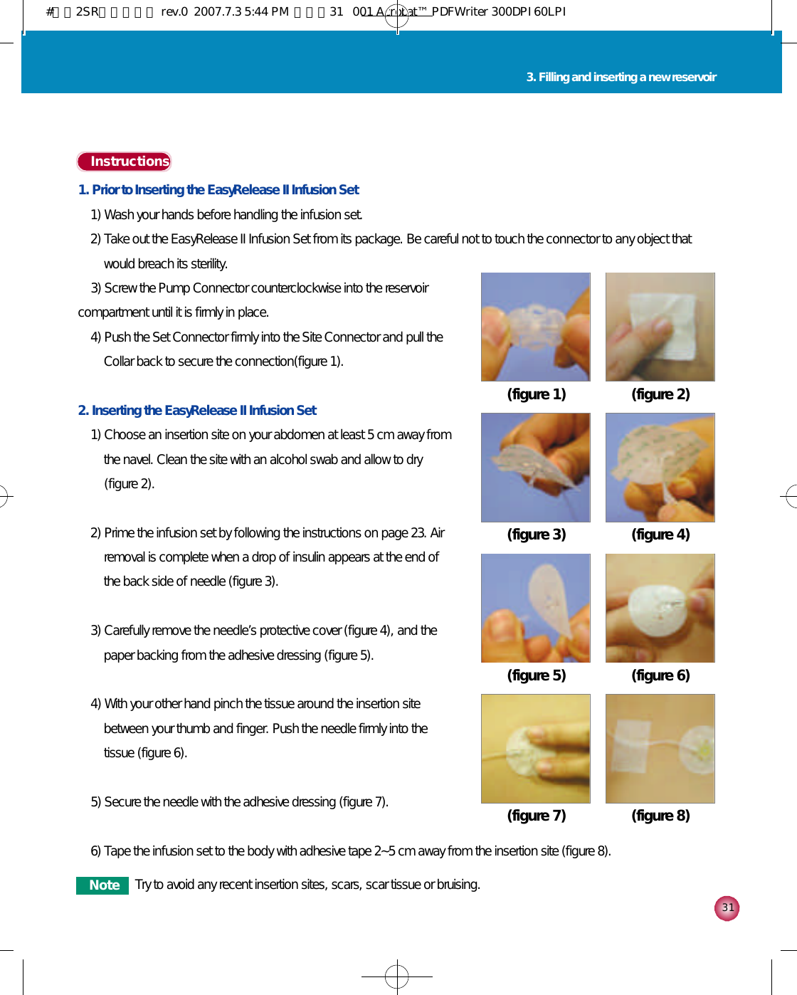 3 13. Filling and inserting a new reservoir1. Prior to Inserting the EasyRelease II Infusion Set1) Wash your hands before handling the infusion set. 2) Take out the EasyRelease II Infusion Set from its package. Be careful not to touch the connector to any object thatwould breach its sterility.3) Screw the Pump Connector counterclockwise into the reservoircompartment until it is firmly in place. 4) Push the Set Connector firmly into the Site Connector and pull theCollar back to secure the connection(figure 1).2. Inserting the EasyRelease II Infusion Set1) Choose an insertion site on your abdomen at least 5 cm away fromthe navel. Clean the site with an alcohol swab and allow to dry(figure 2).2) Prime the infusion set by following the instructions on page 23. Airremoval is complete when a drop of insulin appears at the end ofthe back side of needle (figure 3).3) Carefully remove the needle’s protective cover (figure 4), and thepaper backing from the adhesive dressing (figure 5). 4) With your other hand pinch the tissue around the insertion sitebetween your thumb and finger. Push the needle firmly into thetissue (figure 6). 5) Secure the needle with the adhesive dressing (figure 7). 6) Tape the infusion set to the body with adhesive tape 2~5 cm away from the insertion site (figure 8). I n s t r u c t i o n s(figure 1) (figure 2)(figure 3) (figure 4)(figure 5) (figure 6)(figure 7) (figure 8)N o t e Try to avoid any recent insertion sites, scars, scar tissue or bruising.#다나2SR영문메뉴얼 rev.0  2007.7.3 5:44 PM  페이지31   001 Acrobat™ PDFWriter 300DPI 60LPI