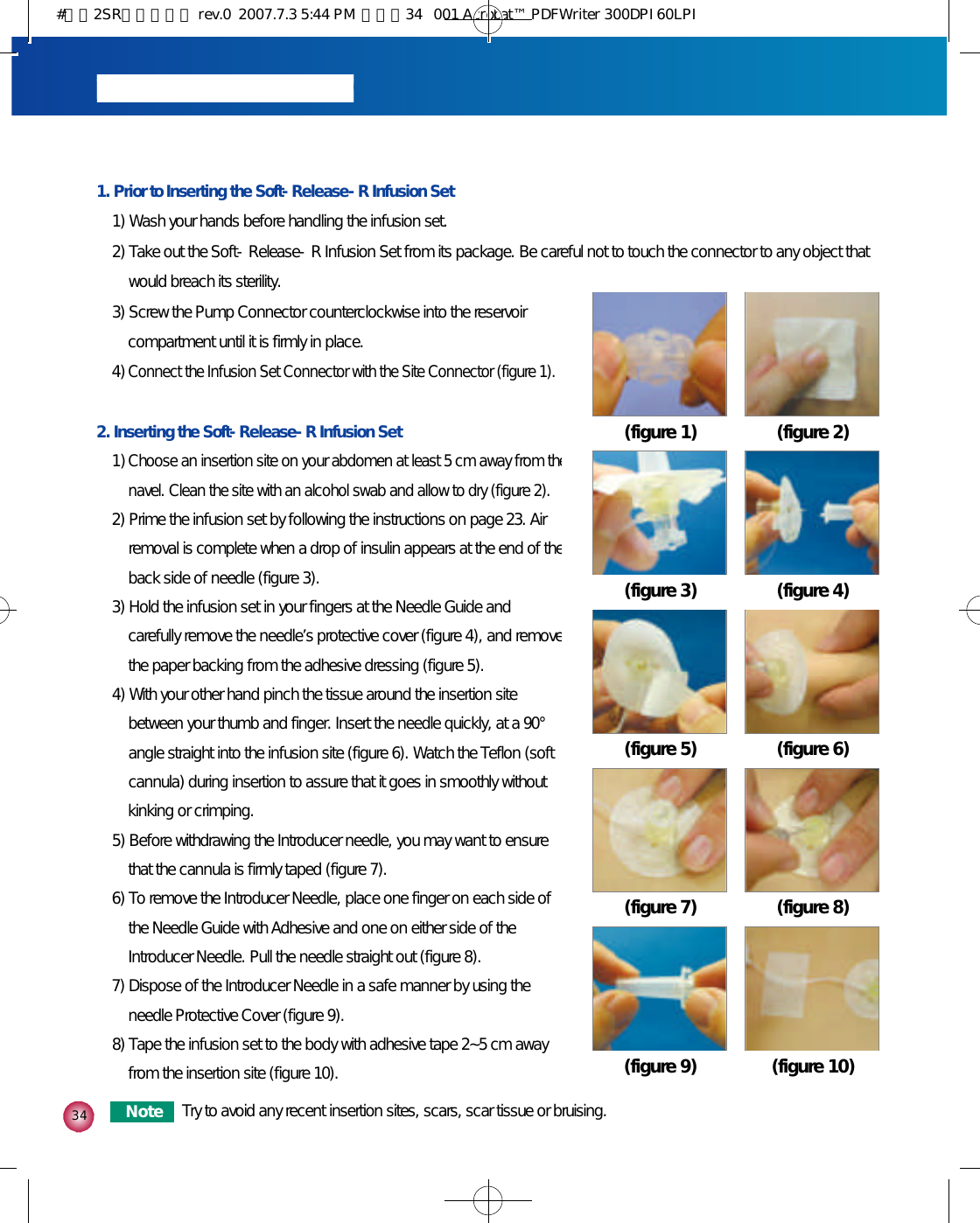 3 41. Prior to Inserting the Soft-Release-R Infusion Set1) Wash your hands before handling the infusion set. 2) Take out the Soft-Release-R Infusion Set from its package. Be careful not to touch the connector to any object thatwould breach its sterility.3) Screw the Pump Connector counterclockwise into the reservoircompartment until it is firmly in place. 4) Connect the Infusion Set Connector with the Site Connector (figure 1).2. Inserting the Soft-Release-R Infusion Set1) Choose an insertion site on your abdomen at least 5 cm away from thenavel. Clean the site with an alcohol swab and allow to dry (figure 2).2) Prime the infusion set by following the instructions on page 23. Airremoval is complete when a drop of insulin appears at the end of theback side of needle (figure 3).3) Hold the infusion set in your fingers at the Needle Guide andcarefully remove the needle’s protective cover (figure 4), and removethe paper backing from the adhesive dressing (figure 5). 4) With your other hand pinch the tissue around the insertion sitebetween your thumb and finger. Insert the needle quickly, at a 90°angle straight into the infusion site (figure 6). Watch the Teflon (softcannula) during insertion to assure that it goes in smoothly withoutkinking or crimping. 5) Before withdrawing the Introducer needle, you may want to ensurethat the cannula is firmly taped (figure 7). 6) To remove the Introducer Needle, place one finger on each side ofthe Needle Guide with Adhesive and one on either side of theIntroducer Needle. Pull the needle straight out (figure 8). 7) Dispose of the Introducer Needle in a safe manner by using theneedle Protective Cover (figure 9). 8) Tape the infusion set to the body with adhesive tape 2~5 cm awayfrom the insertion site (figure 10).(figure 2)(figure 1)(figure 4)(figure 3)(figure 6)(figure 5)(figure 8)(figure 7)(figure 10)(figure 9)N o t e Try to avoid any recent insertion sites, scars, scar tissue or bruising.#다나2SR영문메뉴얼 rev.0  2007.7.3 5:44 PM  페이지34   001 Acrobat™ PDFWriter 300DPI 60LPI