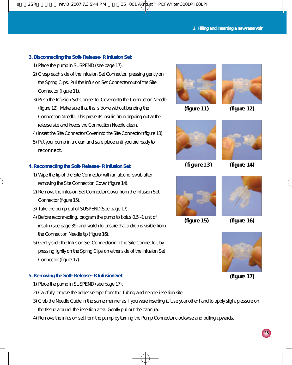 3 53. Filling and inserting a new reservoir3. Disconnecting the Soft-Release-R Infusion Set1) Place the pump in SUSPEND (see page 17).2) Grasp each side of the Infusion Set Connector, pressing gently onthe Spring Clips. Pull the Infusion Set Connector out of the SiteConnector (figure 11).3) Push the Infusion Set Connector Cover onto the Connection Needle(figure 12). Make sure that this is done without bending theConnection Needle. This prevents insulin from dripping out at therelease site and keeps the Connection Needle clean. 4) Insert the Site Connector Cover into the Site Connector (figure 13).5) Put your pump in a clean and safe place until you are ready tor e c o n n e c t .4. Reconnecting the Soft-Release-R Infusion Set1) Wipe the tip of the Site Connector with an alcohol swab afterremoving the Site Connection Cover (figure 14).2) Remove the Infusion Set Connector Cover from the Infusion SetConnector (figure 15).3) Take the pump out of SUSPEND(See page 17).4) Before reconnecting, program the pump to bolus 0.5~1 unit ofinsulin (see page 39) and watch to ensure that a drop is visible fromthe Connection Needle tip (figure 16).5) Gently slide the Infusion Set Connector into the Site Connector, bypressing lightly on the Spring Clips on either side of the Infusion SetConnector (figure 17).5. Removing the Soft-Release-R Infusion Set1) Place the pump in SUSPEND (see page 17). 2) Carefully remove the adhesive tape from the Tubing and needle insertion site.3) Grab the Needle Guide in the same manner as if you were inserting it. Use your other hand to apply slight pressure onthe tissue around  the insertion area. Gently pull out the cannula.4) Remove the infusion set from the pump by turning the Pump Connector clockwise and pulling upwards.(figure 11) (figure 12)( f i g u r e 1 3 ) (figure 14)(figure 15) (figure 16)(figure 17)#다나2SR영문메뉴얼 rev.0  2007.7.3 5:44 PM  페이지35   001 Acrobat™ PDFWriter 300DPI 60LPI