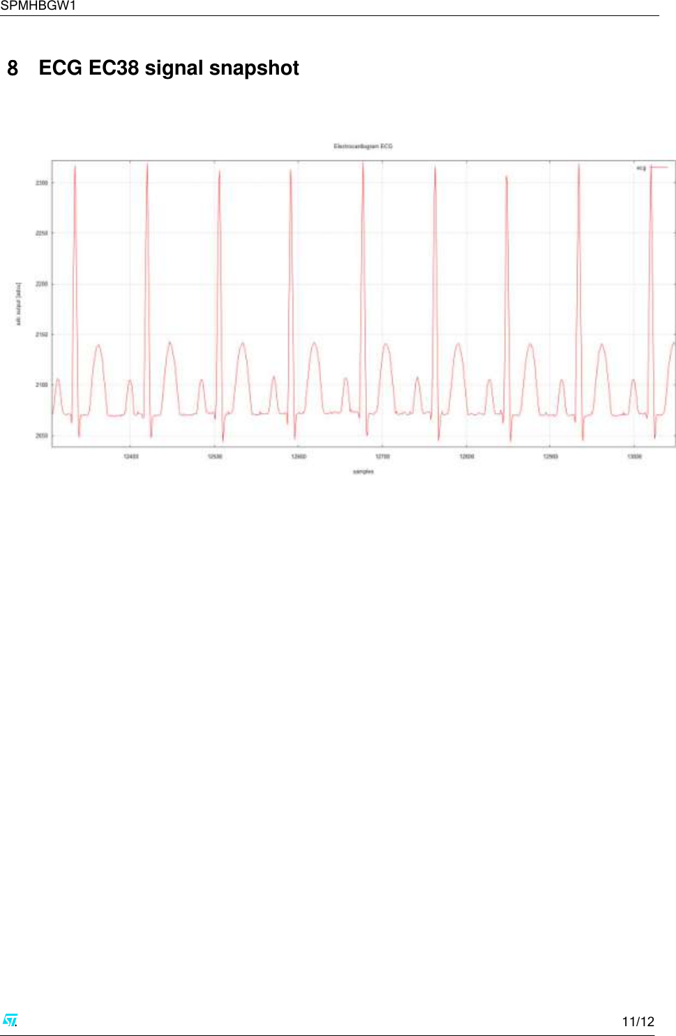 SPMHBGW1     11/12   8  ECG EC38 signal snapshot      