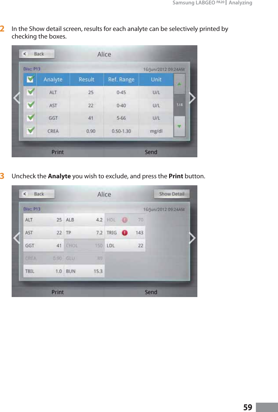 59Samsung LABGEO PA20   Analyzing2  In the Show detail screen, results for each analyte can be selectively printed by checking the boxes. 3  Uncheck the Analyte you wish to exclude, and press the Print button.