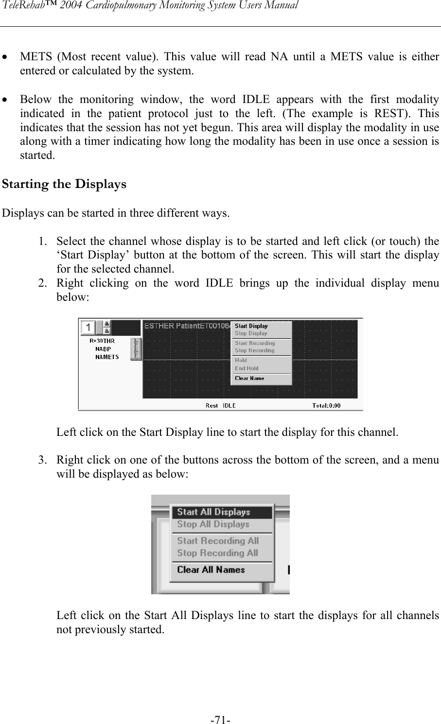 TeleRehab™ 2004 Cardiopulmonary Monitoring System Users Manual    -71- • METS (Most recent value). This value will read NA until a METS value is either entered or calculated by the system.     • Below the monitoring window, the word IDLE appears with the first modality indicated in the patient protocol just to the left. (The example is REST). This indicates that the session has not yet begun. This area will display the modality in use along with a timer indicating how long the modality has been in use once a session is started.  Starting the Displays  Displays can be started in three different ways.  1. Select the channel whose display is to be started and left click (or touch) the ‘Start Display’ button at the bottom of the screen. This will start the display for the selected channel. 2. Right clicking on the word IDLE brings up the individual display menu below:                  Left click on the Start Display line to start the display for this channel.   3. Right click on one of the buttons across the bottom of the screen, and a menu will be displayed as below:     Left click on the Start All Displays line to start the displays for all channels not previously started.     