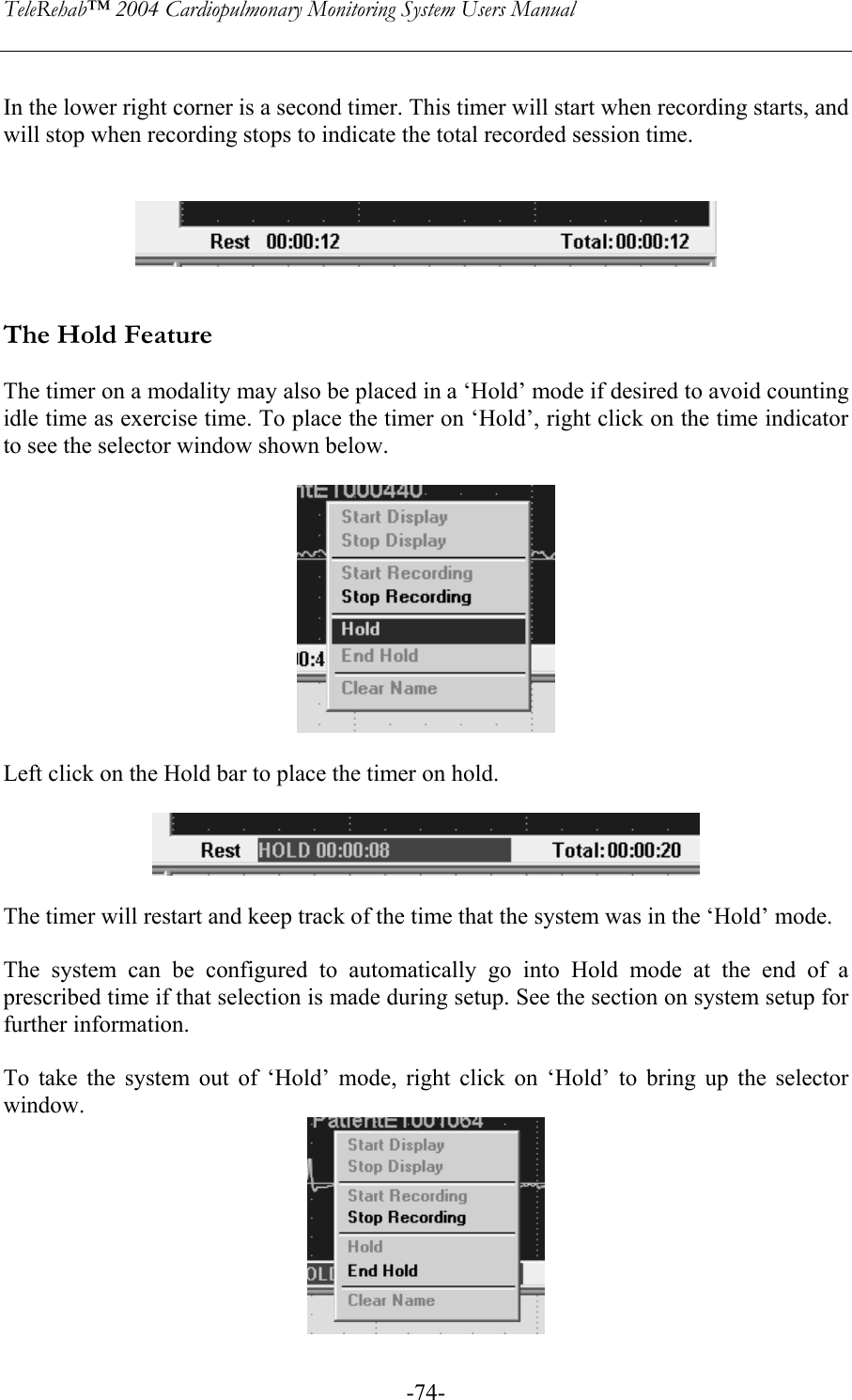 TeleRehab™ 2004 Cardiopulmonary Monitoring System Users Manual    -74- In the lower right corner is a second timer. This timer will start when recording starts, and will stop when recording stops to indicate the total recorded session time.      The Hold Feature  The timer on a modality may also be placed in a ‘Hold’ mode if desired to avoid counting idle time as exercise time. To place the timer on ‘Hold’, right click on the time indicator to see the selector window shown below.    Left click on the Hold bar to place the timer on hold.     The timer will restart and keep track of the time that the system was in the ‘Hold’ mode.  The system can be configured to automatically go into Hold mode at the end of a prescribed time if that selection is made during setup. See the section on system setup for further information.   To take the system out of ‘Hold’ mode, right click on ‘Hold’ to bring up the selector window.  