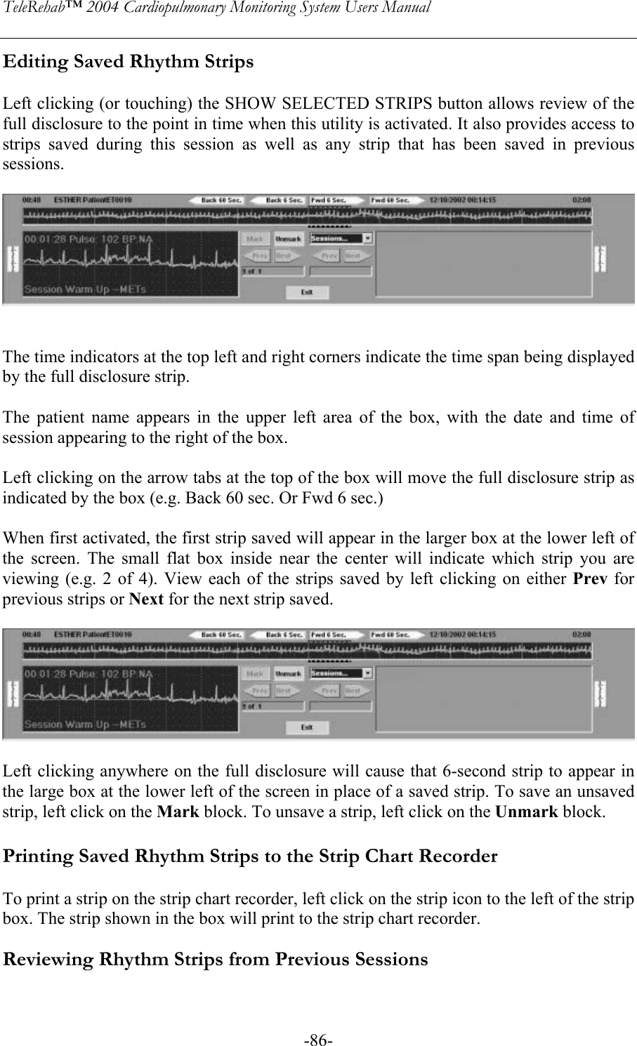 TeleRehab™ 2004 Cardiopulmonary Monitoring System Users Manual    -86-Editing Saved Rhythm Strips  Left clicking (or touching) the SHOW SELECTED STRIPS button allows review of the full disclosure to the point in time when this utility is activated. It also provides access to strips saved during this session as well as any strip that has been saved in previous sessions.     The time indicators at the top left and right corners indicate the time span being displayed by the full disclosure strip.  The patient name appears in the upper left area of the box, with the date and time of session appearing to the right of the box.  Left clicking on the arrow tabs at the top of the box will move the full disclosure strip as indicated by the box (e.g. Back 60 sec. Or Fwd 6 sec.)  When first activated, the first strip saved will appear in the larger box at the lower left of the screen. The small flat box inside near the center will indicate which strip you are viewing (e.g. 2 of 4). View each of the strips saved by left clicking on either Prev for previous strips or Next for the next strip saved.     Left clicking anywhere on the full disclosure will cause that 6-second strip to appear in the large box at the lower left of the screen in place of a saved strip. To save an unsaved strip, left click on the Mark block. To unsave a strip, left click on the Unmark block.  Printing Saved Rhythm Strips to the Strip Chart Recorder  To print a strip on the strip chart recorder, left click on the strip icon to the left of the strip box. The strip shown in the box will print to the strip chart recorder.  Reviewing Rhythm Strips from Previous Sessions  