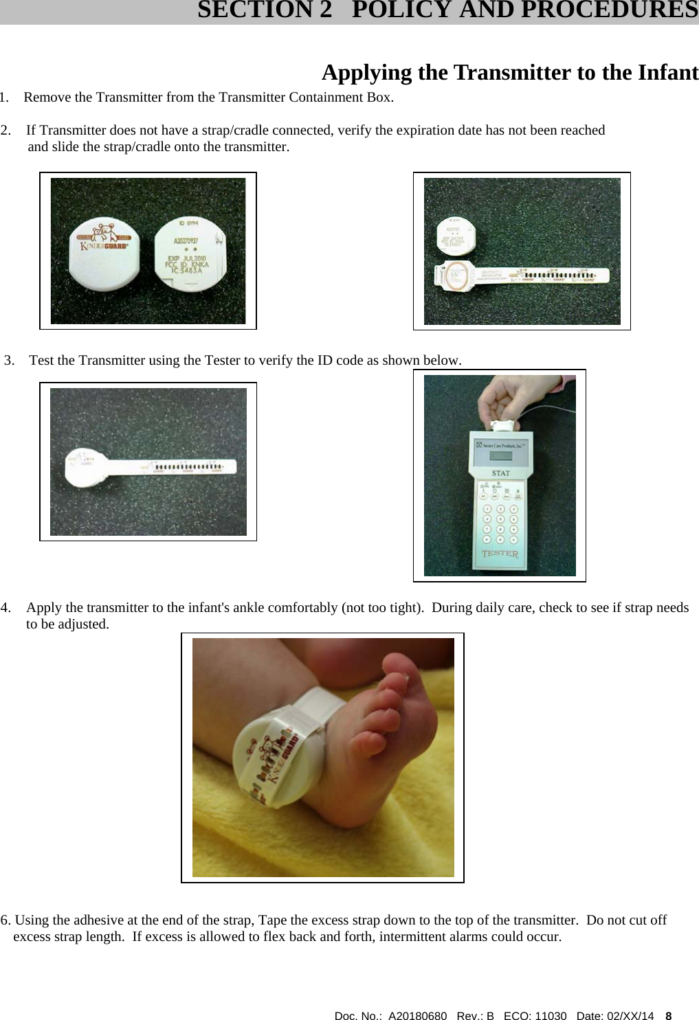  Doc. No.:  A20180680   Rev.: B   ECO: 11030   Date: 02/XX/14    8               Applying the Transmitter to the Infant    1.    Remove the Transmitter from the Transmitter Containment Box. 2. If Transmitter does not have a strap/cradle connected, verify the expiration date has not been reached      and slide the strap/cradle onto the transmitter.                                                                                              3.    Test the Transmitter using the Tester to verify the ID code as shown below.                                                                                                 4. Apply the transmitter to the infant&apos;s ankle comfortably (not too tight).  During daily care, check to see if strap needs to be adjusted.                                                                    6. Using the adhesive at the end of the strap, Tape the excess strap down to the top of the transmitter.  Do not cut off excess strap length.  If excess is allowed to flex back and forth, intermittent alarms could occur.    SECTION 2   POLICY AND PROCEDURES 