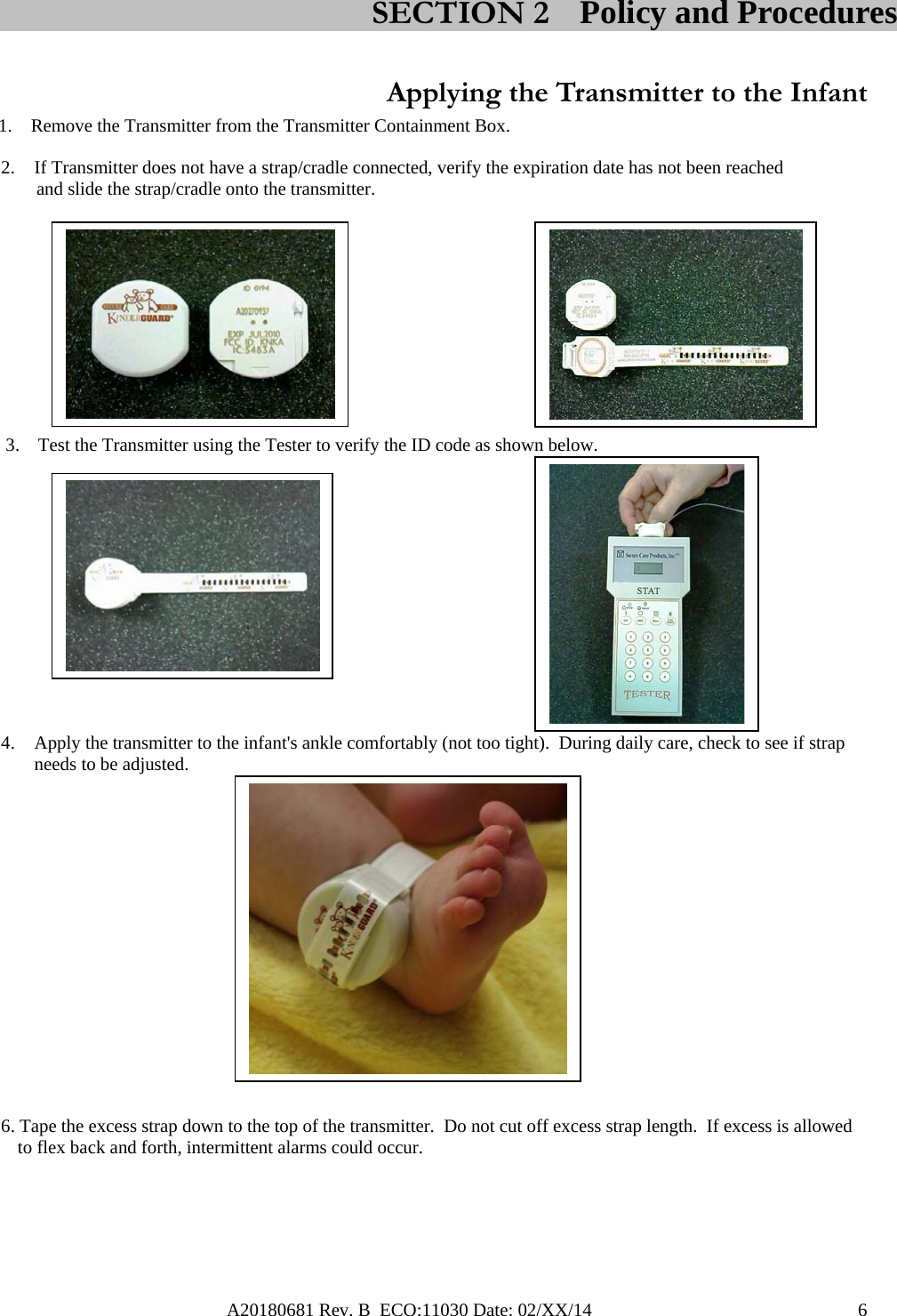 A20180681 Rev. B  ECO:11030 Date: 02/XX/14                                               6  Applying the Transmitter to the Infant    1.    Remove the Transmitter from the Transmitter Containment Box. 2. If Transmitter does not have a strap/cradle connected, verify the expiration date has not been reached      and slide the strap/cradle onto the transmitter.                                                                                             3.    Test the Transmitter using the Tester to verify the ID code as shown below.                                                                                                4. Apply the transmitter to the infant&apos;s ankle comfortably (not too tight).  During daily care, check to see if strap needs to be adjusted.                                                                   6. Tape the excess strap down to the top of the transmitter.  Do not cut off excess strap length.  If excess is allowed to flex back and forth, intermittent alarms could occur.              SECTION 2 Policy and Procedures 