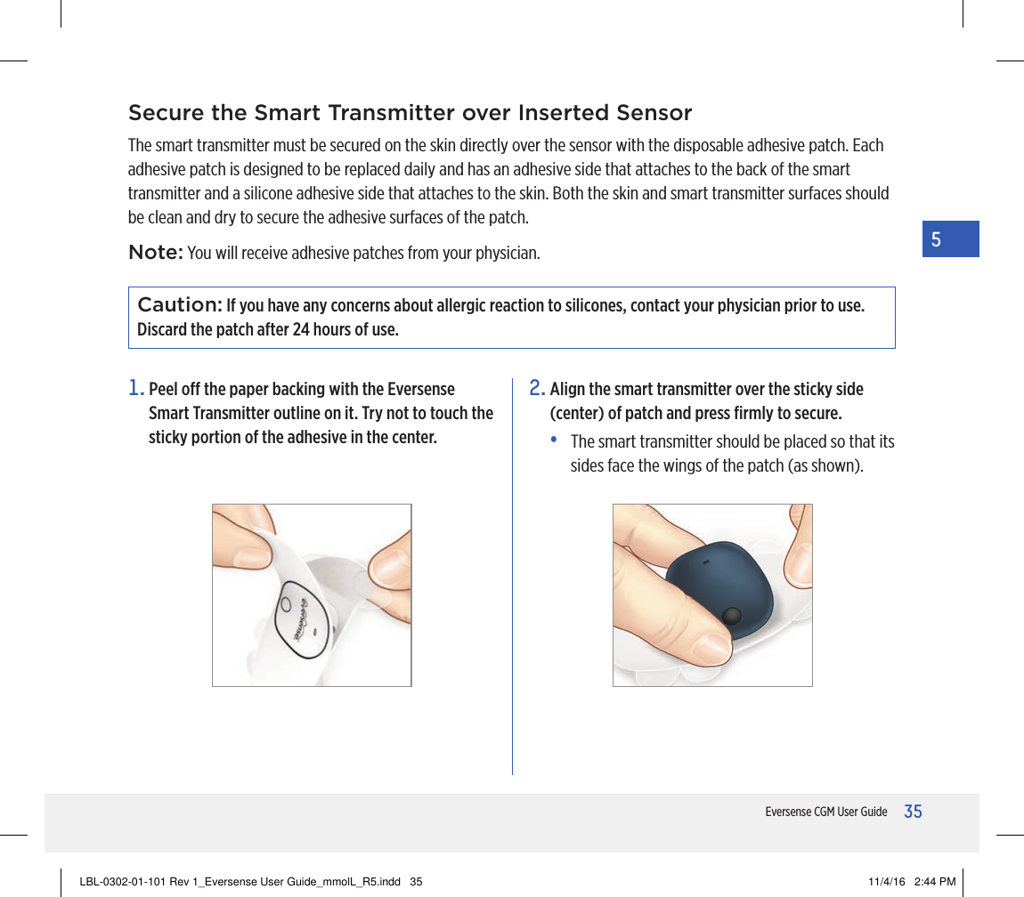 35Eversense CGM User Guide5Caution: If you have any concerns about allergic reaction to silicones, contact your physician prior to use. Discard the patch after 24 hours of use.Secure the Smart Transmitter over Inserted SensorThe smart transmitter must be secured on the skin directly over the sensor with the disposable adhesive patch. Each adhesive patch is designed to be replaced daily and has an adhesive side that attaches to the back of the smart transmitter and a silicone adhesive side that attaches to the skin. Both the skin and smart transmitter surfaces should be clean and dry to secure the adhesive surfaces of the patch.1.  Peel o the paper backing with the Eversense Smart Transmitter outline on it. Try not to touch the sticky portion of the adhesive in the center. 2.  Align the smart transmitter over the sticky side (center) of patch and press ﬁrmly to secure.•   The smart transmitter should be placed so that its sides face the wings of the patch (as shown).Note: You will receive adhesive patches from your physician.LBL-0302-01-101 Rev 1_Eversense User Guide_mmolL_R5.indd   35 11/4/16   2:44 PM