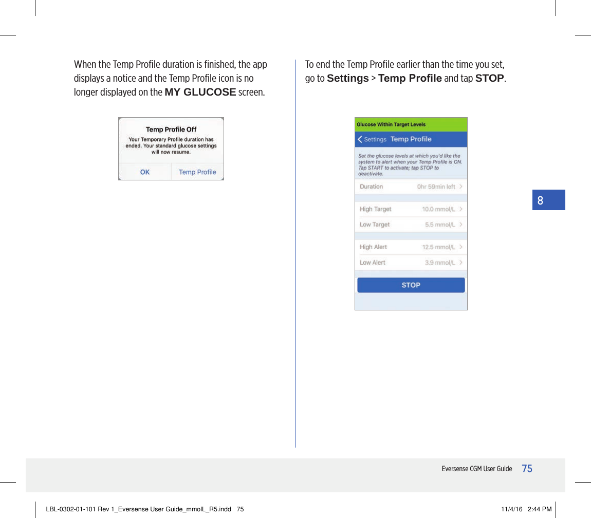 75Eversense CGM User Guide8When the Temp Proﬁle duration is ﬁnished, the app displays a notice and the Temp Proﬁle icon is no longer displayed on the MY GLUCOSE screen.To end the Temp Proﬁle earlier than the time you set, go to Settings &gt; Temp Prole and tap STOP.LBL-0302-01-101 Rev 1_Eversense User Guide_mmolL_R5.indd   75 11/4/16   2:44 PM