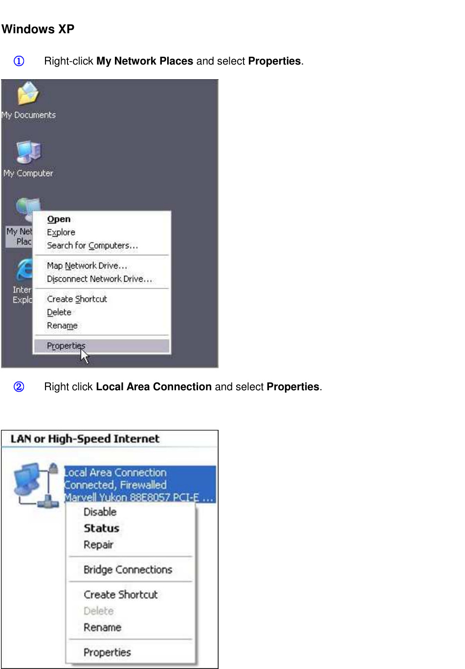                                                         Windows XP ①①①① Right-click My Network Places and select Properties.  ②②②② Right click Local Area Connection and select Properties.   