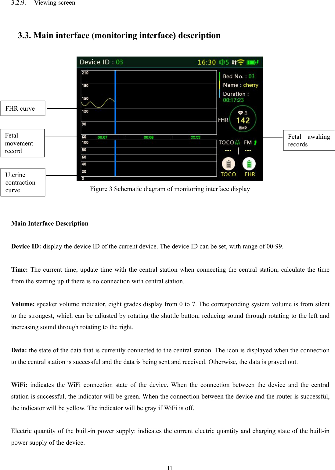 113.2.9. Viewing screen3.3. Main interface (monitoring interface) descriptionFigure 3 Schematic diagram of monitoring interface displayMain Interface DescriptionDevice ID: display the device ID of the current device. The device ID can be set, with range of 00-99.Time: The current time, update time with the central station when connecting the central station, calculate the timefrom the starting up if there is no connection with central station.Volume: speaker volume indicator, eight grades display from 0 to 7. The corresponding system volume is from silentto the strongest, which can be adjusted by rotating the shuttle button, reducing sound through rotating to the left andincreasing sound through rotating to the right.Data: the state of the data that is currently connected to the central station. The icon is displayed when the connectionto the central station is successful and the data is being sent and received. Otherwise, the data is grayed out.WiFi: indicates the WiFi connection state of the device. When the connection between the device and the centralstation is successful, the indicator will be green. When the connection between the device and the router is successful,the indicator will be yellow. The indicator will be gray if WiFi is off.Electric quantity of the built-in power supply: indicates the current electric quantity and charging state of the built-inpower supply of the device.FHR curveFetalmovementrecordUterinecontractioncurveFetal awakingrecords