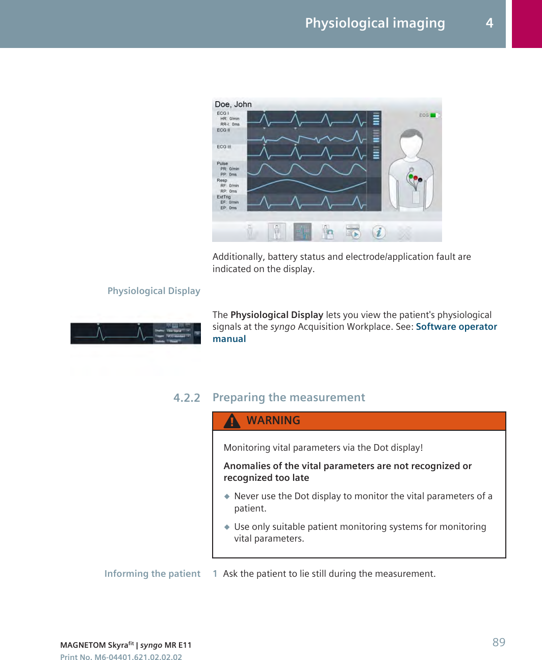 Additionally, battery status and electrode/application fault areindicated on the display.The Physiological Display lets you view the patient&apos;s physiologicalsignals at the syngo Acquisition Workplace. See: Software operatormanualPreparing the measurementWARNINGMonitoring vital parameters via the Dot display!Anomalies of the vital parameters are not recognized orrecognized too late◆Never use the Dot display to monitor the vital parameters of apatient.◆Use only suitable patient monitoring systems for monitoringvital parameters.1Ask the patient to lie still during the measurement.Physiological Display4.2.2Informing the patientPhysiological imaging 4MAGNETOM Skyrafit | syngo MR E11 89Print No. M6-04401.621.02.02.02