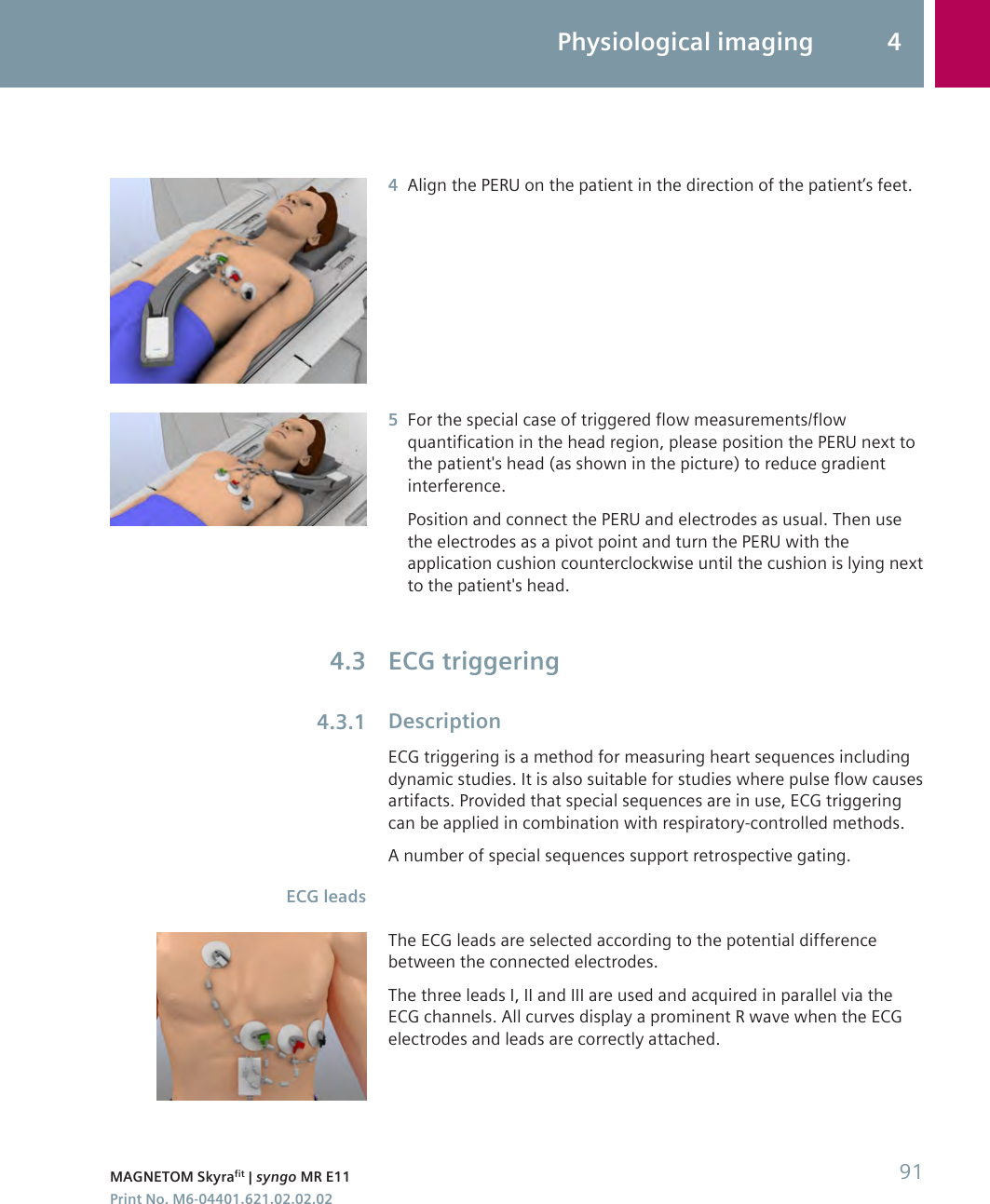 4Align the PERU on the patient in the direction of the patient’s feet.5For the special case of triggered flow measurements/flowquantification in the head region, please position the PERU next tothe patient&apos;s head (as shown in the picture) to reduce gradientinterference.Position and connect the PERU and electrodes as usual. Then usethe electrodes as a pivot point and turn the PERU with theapplication cushion counterclockwise until the cushion is lying nextto the patient&apos;s head.ECG triggeringDescriptionECG triggering is a method for measuring heart sequences includingdynamic studies. It is also suitable for studies where pulse flow causesartifacts. Provided that special sequences are in use, ECG triggeringcan be applied in combination with respiratory-controlled methods.A number of special sequences support retrospective gating.The ECG leads are selected according to the potential differencebetween the connected electrodes.The three leads I, II and III are used and acquired in parallel via theECG channels. All curves display a prominent R wave when the ECGelectrodes and leads are correctly attached.4.34.3.1ECG leadsPhysiological imaging 4MAGNETOM Skyrafit | syngo MR E11 91Print No. M6-04401.621.02.02.02