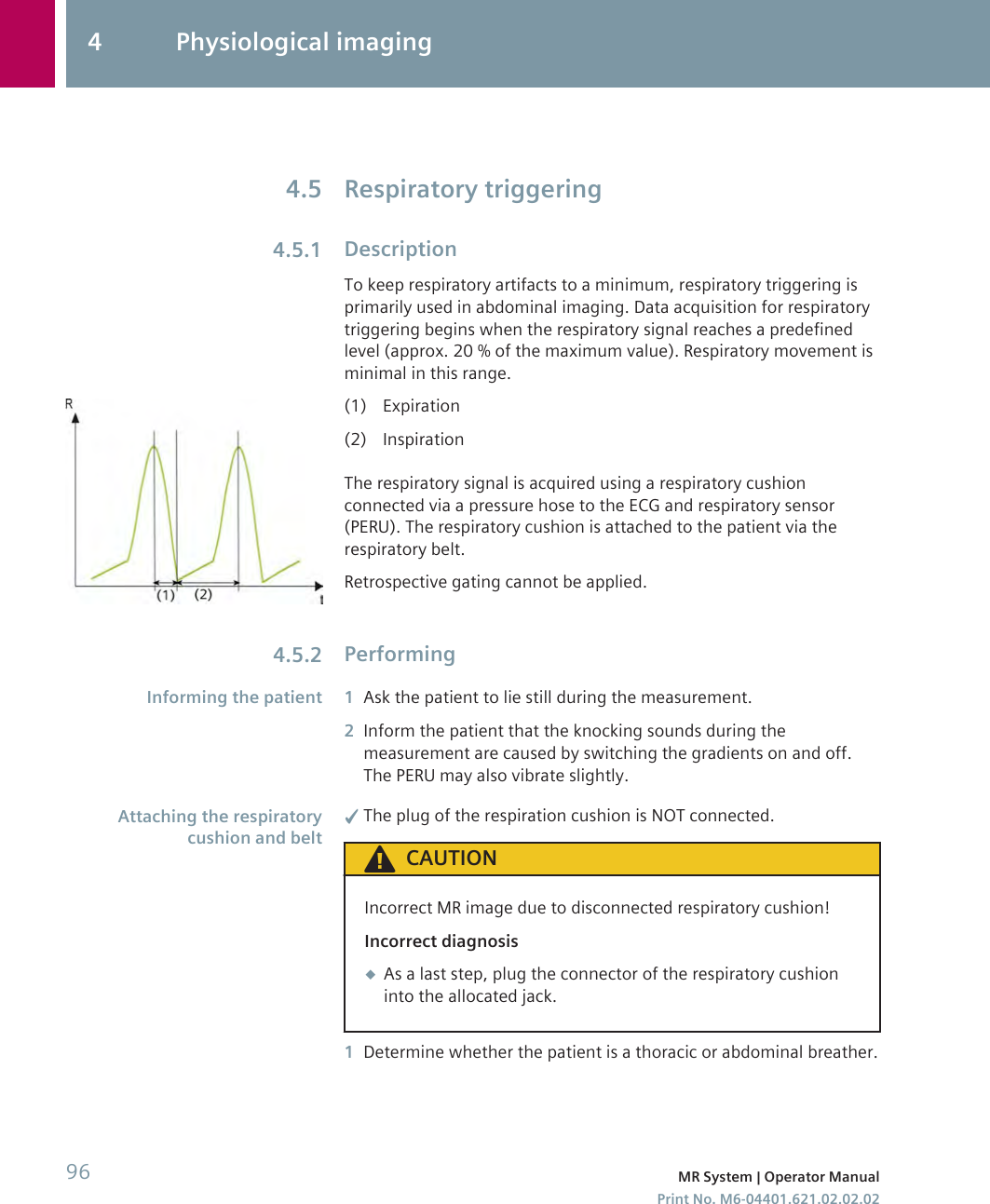 Respiratory triggeringDescriptionTo keep respiratory artifacts to a minimum, respiratory triggering isprimarily used in abdominal imaging. Data acquisition for respiratorytriggering begins when the respiratory signal reaches a predefinedlevel (approx. 20 % of the maximum value). Respiratory movement isminimal in this range.(1) Expiration(2) InspirationThe respiratory signal is acquired using a respiratory cushionconnected via a pressure hose to the ECG and respiratory sensor(PERU). The respiratory cushion is attached to the patient via therespiratory belt.Retrospective gating cannot be applied.Performing1Ask the patient to lie still during the measurement.2Inform the patient that the knocking sounds during themeasurement are caused by switching the gradients on and off.The PERU may also vibrate slightly.✓The plug of the respiration cushion is NOT connected.CAUTIONIncorrect MR image due to disconnected respiratory cushion!Incorrect diagnosis◆As a last step, plug the connector of the respiratory cushioninto the allocated jack.1Determine whether the patient is a thoracic or abdominal breather.4.54.5.14.5.2Informing the patientAttaching the respiratorycushion and belt4 Physiological imaging96 MR System | Operator ManualPrint No. M6-04401.621.02.02.02