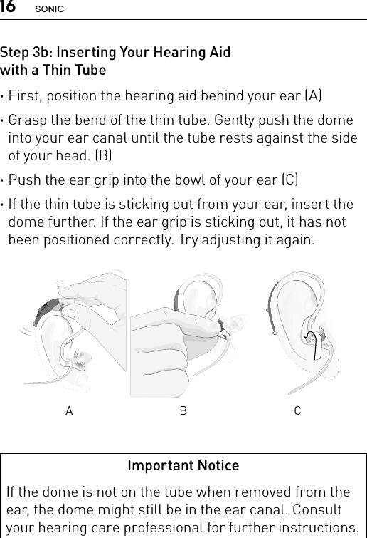 16 SONICStep 3b: Inserting Your Hearing Aid  with a Thin Tube ·First, position the hearing aid behind your ear (A) ·Grasp the bend of the thin tube. Gently push the dome into your ear canal until the tube rests against the side of your head. (B) ·Push the ear grip into the bowl of your ear (C) ·If the thin tube is sticking out from your ear, insert the dome further. If the ear grip is sticking out, it has not been positioned correctly. Try adjusting it again.Bernafon nano BTE IFUVR_ILU_InsertingNanoBTEspira3_BW_HIBernafon nano BTE IFUVR_ILU_InsertingNanoBTEspira1_BW_HIBernafon nano BTE IFUVR_ILU_InsertingNanoBTEspira2_BW_HIA B CImportant NoticeIf the dome is not on the tube when removed from the ear, the dome might still be in the ear canal. Consult your hearing care professional for further instructions.