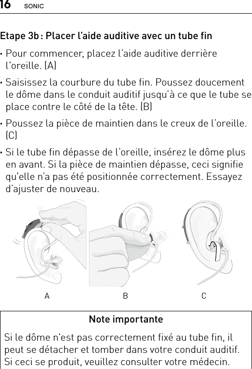 16 SONICNote importanteSi le dôme n&apos;est pas correctement fixé au tube fin, il peut se détacher et tomber dans votre conduit auditif. Si ceci se produit, veuillez consulter votre médecin.Bernafon nano BTE IFUVR_ILU_InsertingNanoBTEspira3_BW_HIBernafon nano BTE IFUVR_ILU_InsertingNanoBTEspira1_BW_HIBernafon nano BTE IFUVR_ILU_InsertingNanoBTEspira2_BW_HIA B CEtape 3b : Placer l’aide auditive avec un tube fin ·Pour commencer, placez l’aide auditive derrière l&apos;oreille. (A) ·Saisissez la courbure du tube fin. Poussez doucement le dôme dans le conduit auditif jusqu’à ce que le tube se place contre le côté de la tête. (B) ·Poussez la pièce de maintien dans le creux de l’oreille. (C) ·Si le tube fin dépasse de l’oreille, insérez le dôme plus en avant. Si la pièce de maintien dépasse, ceci signifie qu&apos;elle n’a pas été positionnée correctement. Essayez d’ajuster de nouveau.