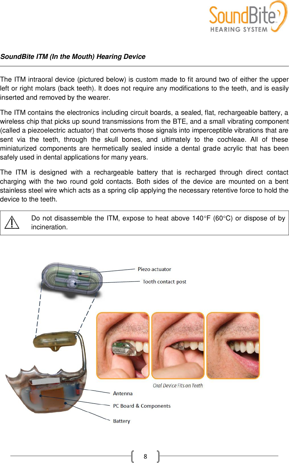    8  SoundBite ITM (In the Mouth) Hearing Device  The ITM intraoral device (pictured below) is custom made to fit around two of either the upper left or right molars (back teeth). It does not require any modifications to the teeth, and is easily inserted and removed by the wearer.  The ITM contains the electronics including circuit boards, a sealed, flat, rechargeable battery, a wireless chip that picks up sound transmissions from the BTE, and a small vibrating component (called a piezoelectric actuator) that converts those signals into imperceptible vibrations that are sent  via  the  teeth,  through  the  skull  bones,  and  ultimately  to  the  cochleae.  All  of  these miniaturized components are hermetically sealed  inside  a dental grade acrylic that  has been safely used in dental applications for many years.  The  ITM  is  designed  with  a  rechargeable  battery  that  is  recharged  through  direct  contact charging  with  the  two  round gold contacts.  Both  sides  of  the device  are  mounted on  a bent stainless steel wire which acts as a spring clip applying the necessary retentive force to hold the device to the teeth.  Do not disassemble the ITM, expose to heat above 140F (60C) or dispose of by incineration.   