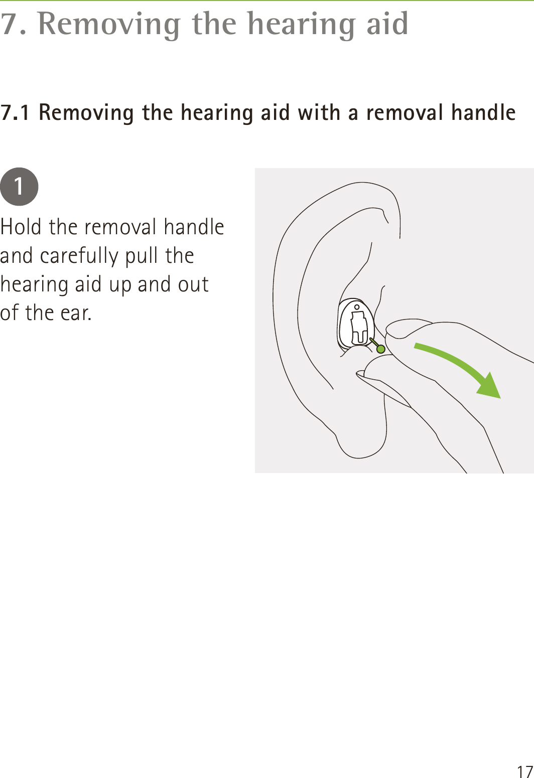 177. Removing the hearing aid7.1 Removing the hearing aid with a removal handle1Hold the removal handle and carefully pull the hearing aid up and out of the ear.