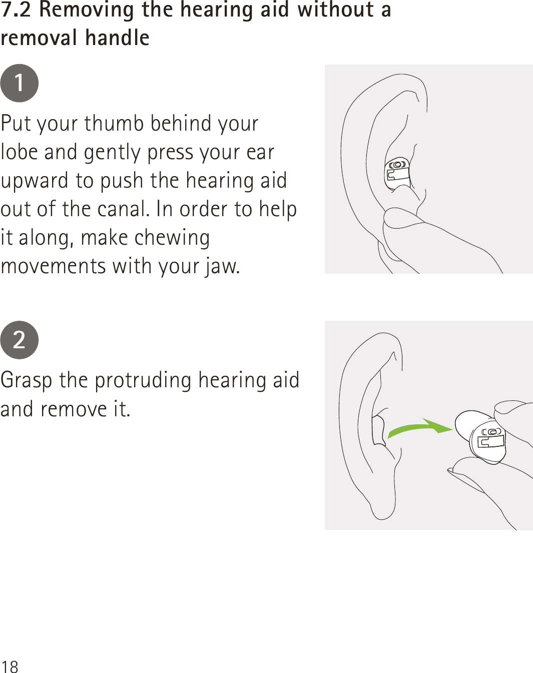 1812Put your thumb behind your lobe and gently press your ear upward to push the hearing aid out of the canal. In order to help it along, make chewing movements with your jaw.Grasp the protruding hearing aid and remove it.7.2 Removing the hearing aid without a  removal handle