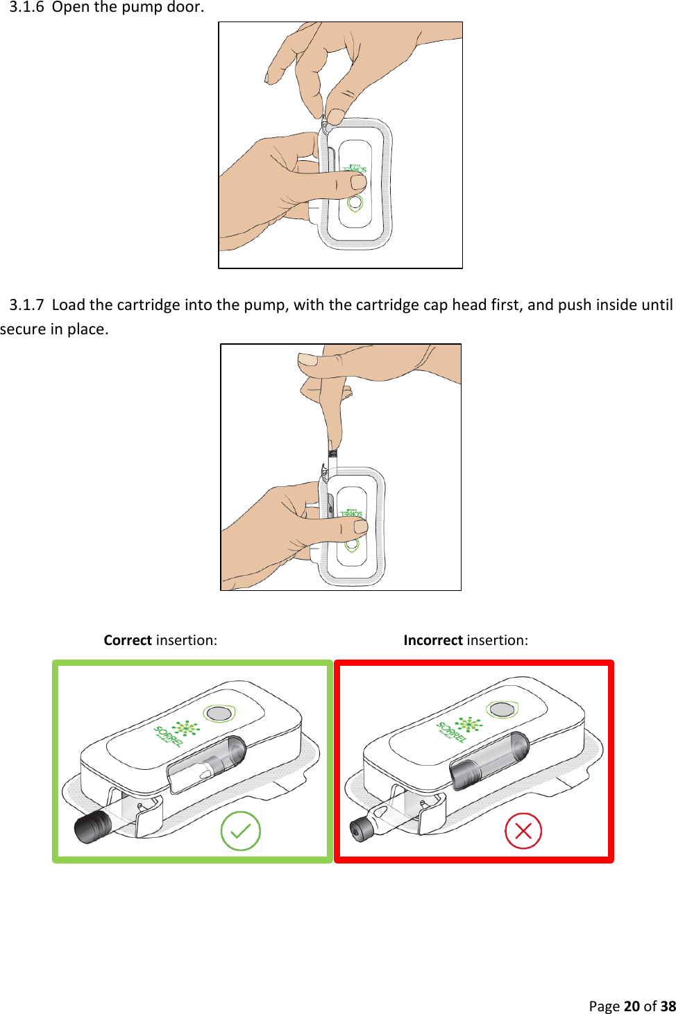  Page 20 of 38 3.1.6 Open the pump door.   3.1.7 Load the cartridge into the pump, with the cartridge cap head first, and push inside until secure in place.   Correct insertion:                         Incorrect insertion:             